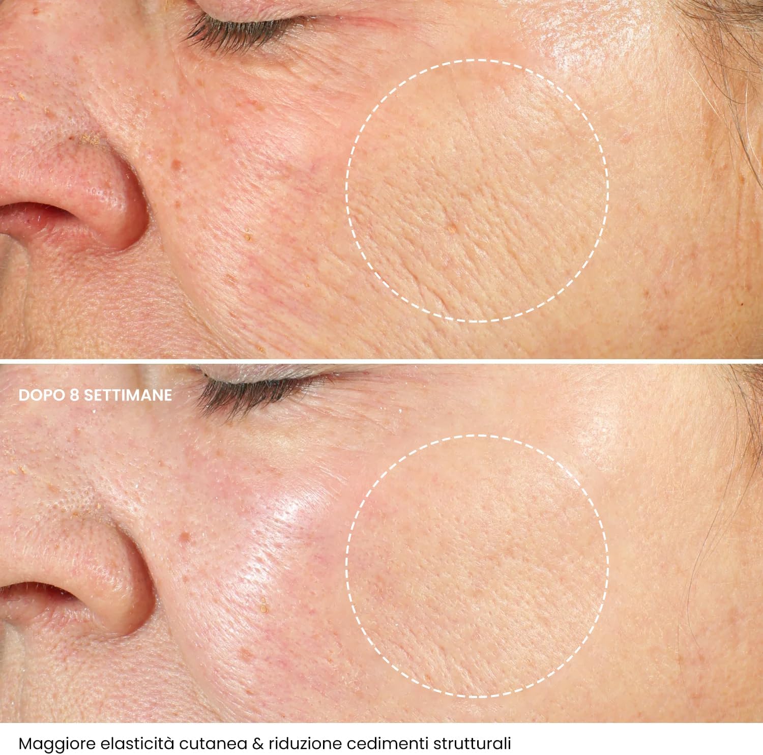 Thumbnail 4 de Crema Viso Antirughe 50ml con Acido Ialuronico