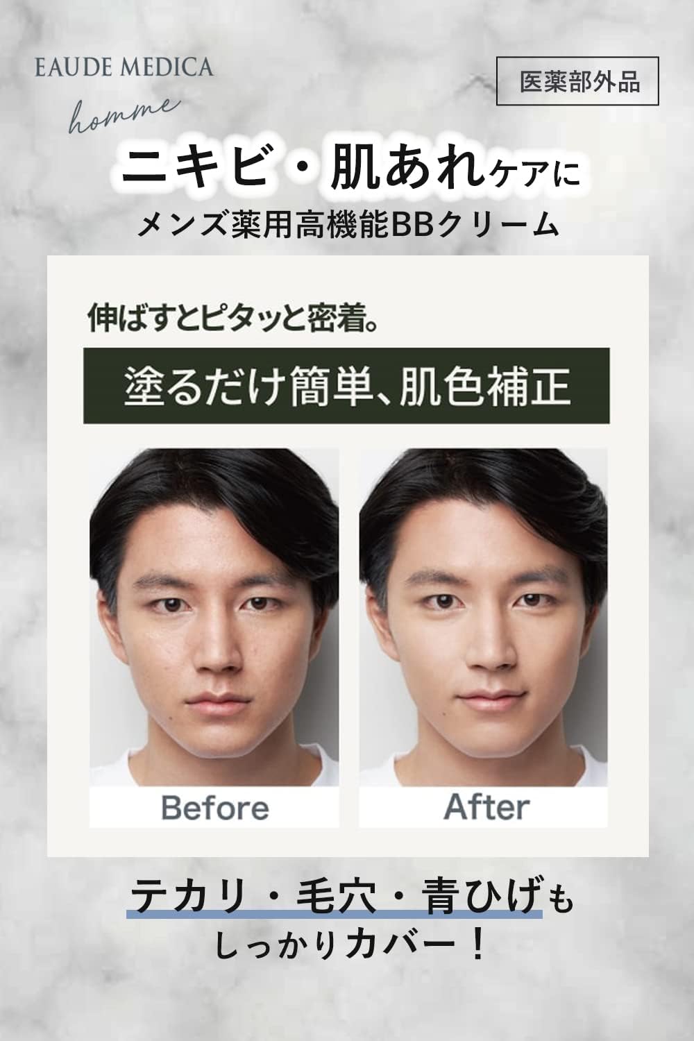 Detalle de オードメディカオム 薬用アクネケアBB 30g イエローベージュ02 SPF36 PA+++ メンズBBクリーム