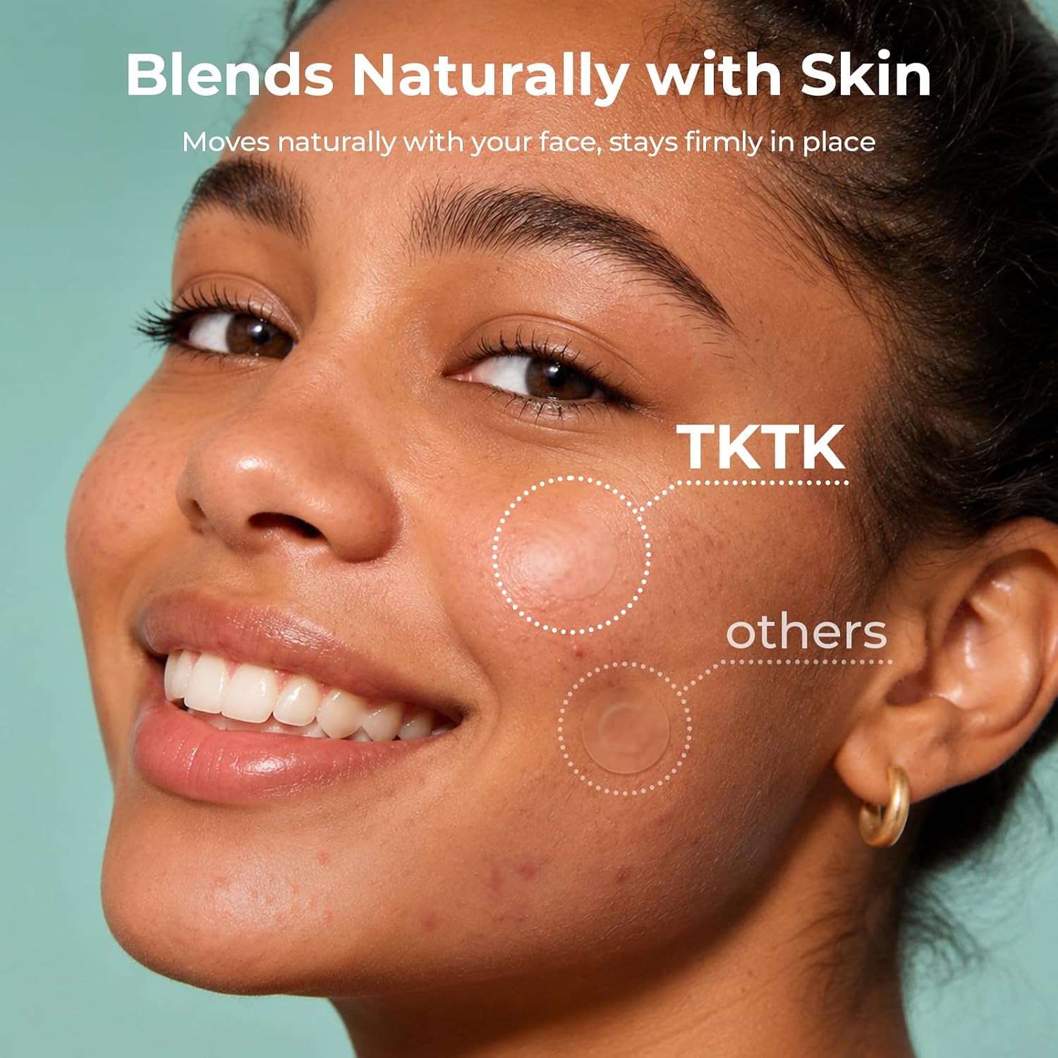 Detalle de TKTK Hydrocolloid Pimple Patches, 120 Count