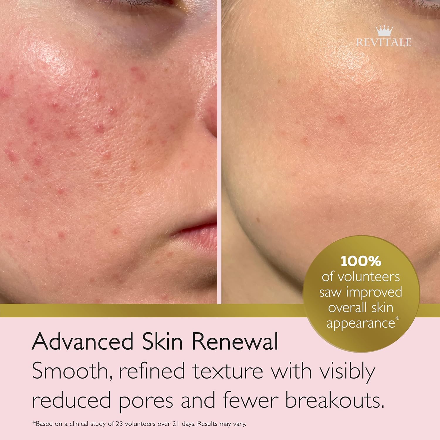 Thumbnail 1 de Revitale Crema avanzata 80 g per viso e corpo