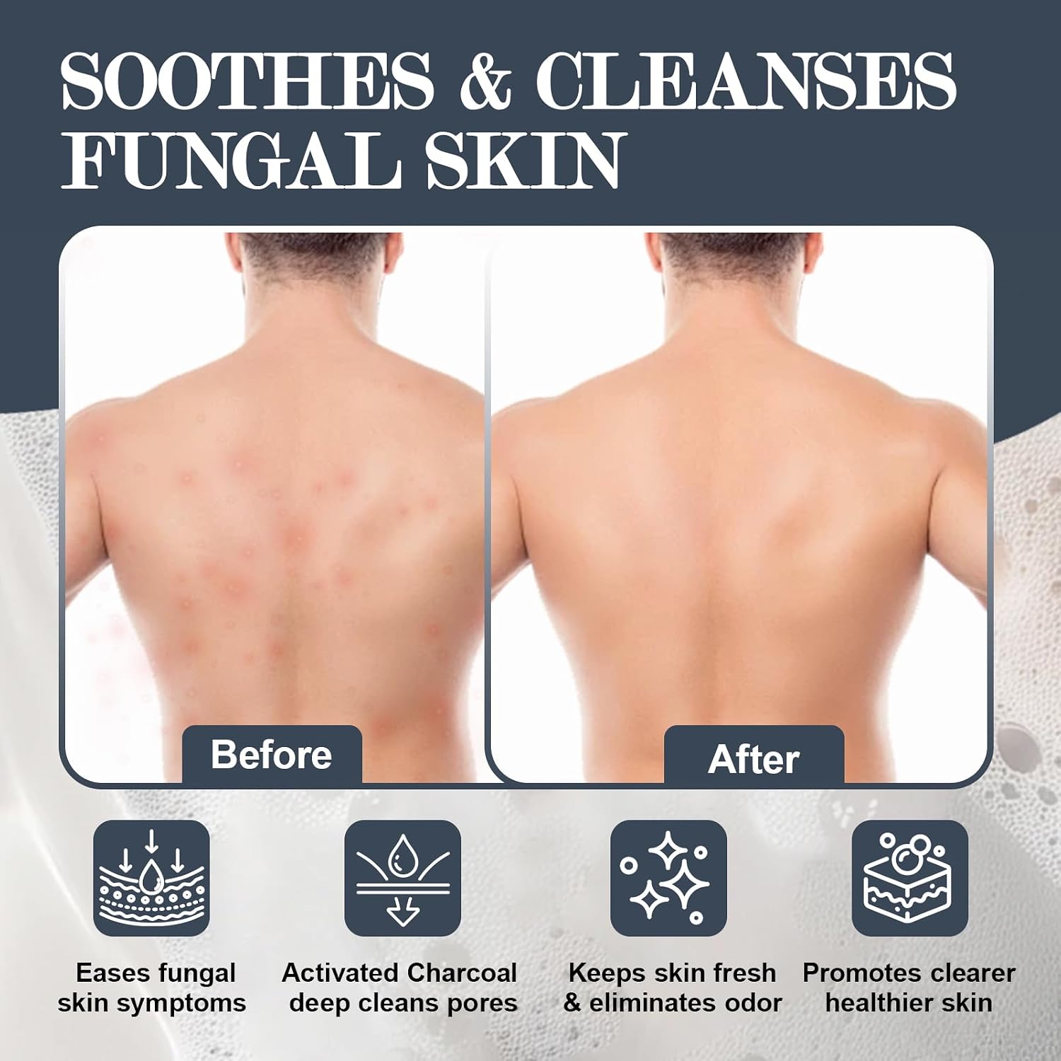 Thumbnail 4 de Antifungal Soap, 3-Bar Pack