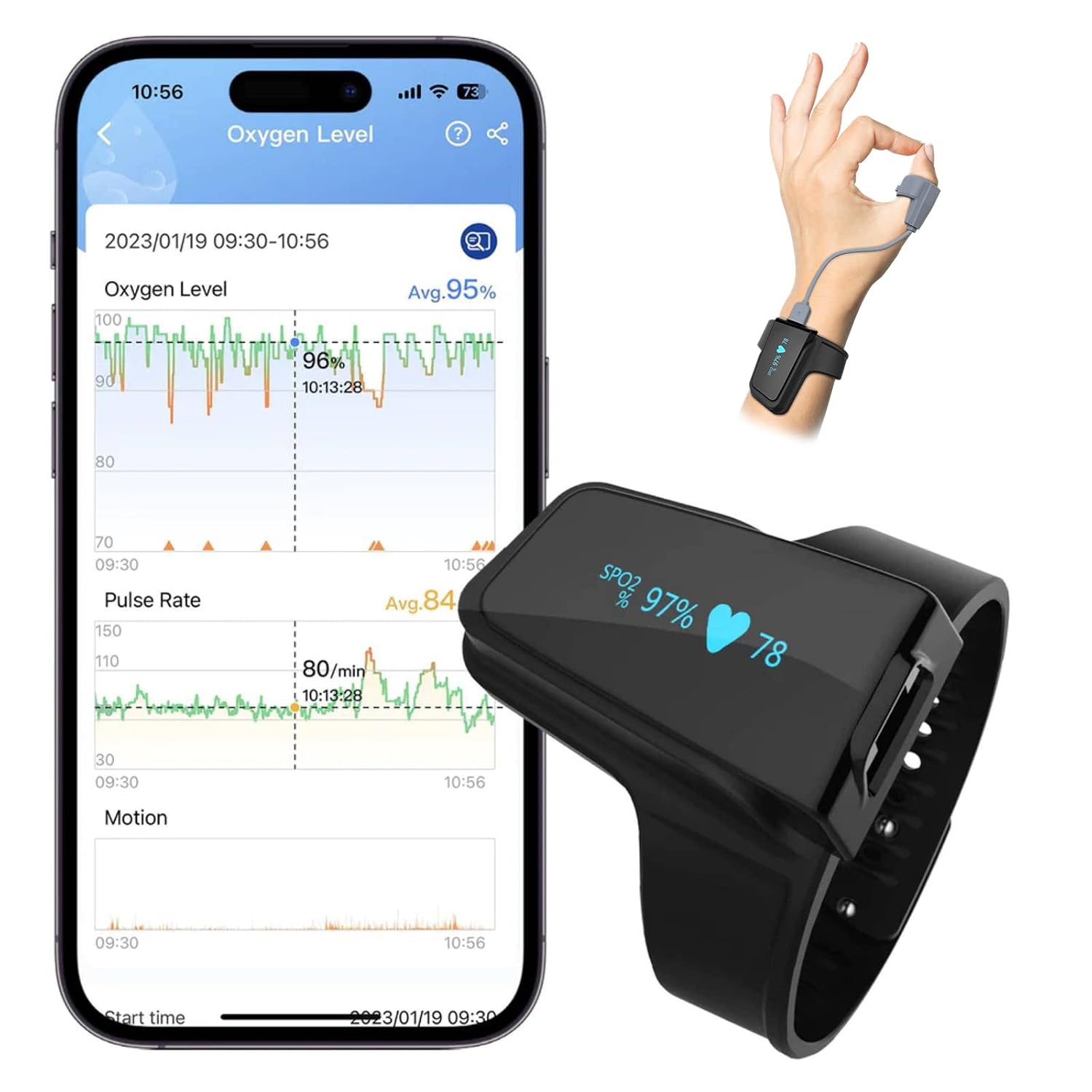 Detalle de ViATOM Pulsioximetro Profesional polspulsoximeter met app en alarm