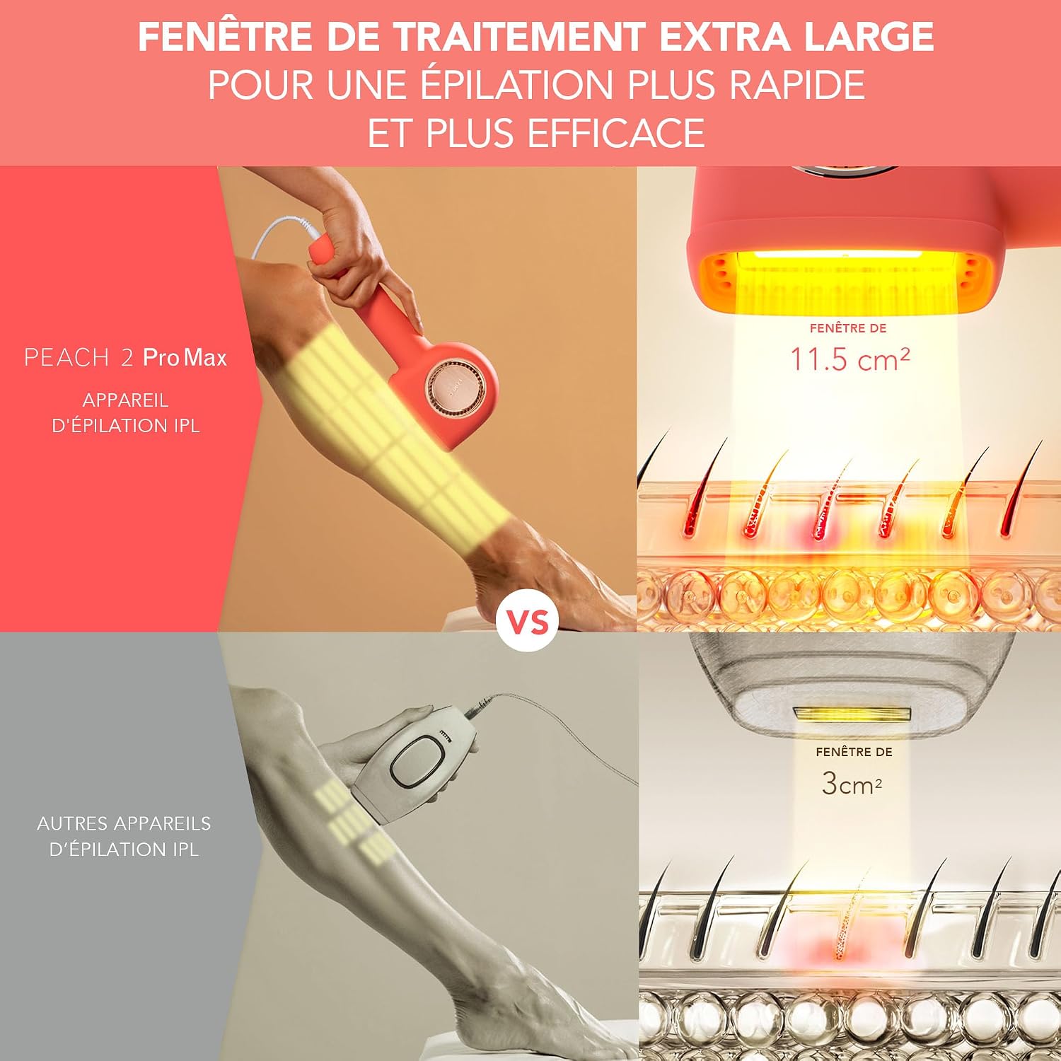 Thumbnail 2 de FOREO PEACH 2 Pro Max – Appareil IPL pour épilation visage & corps à domicile