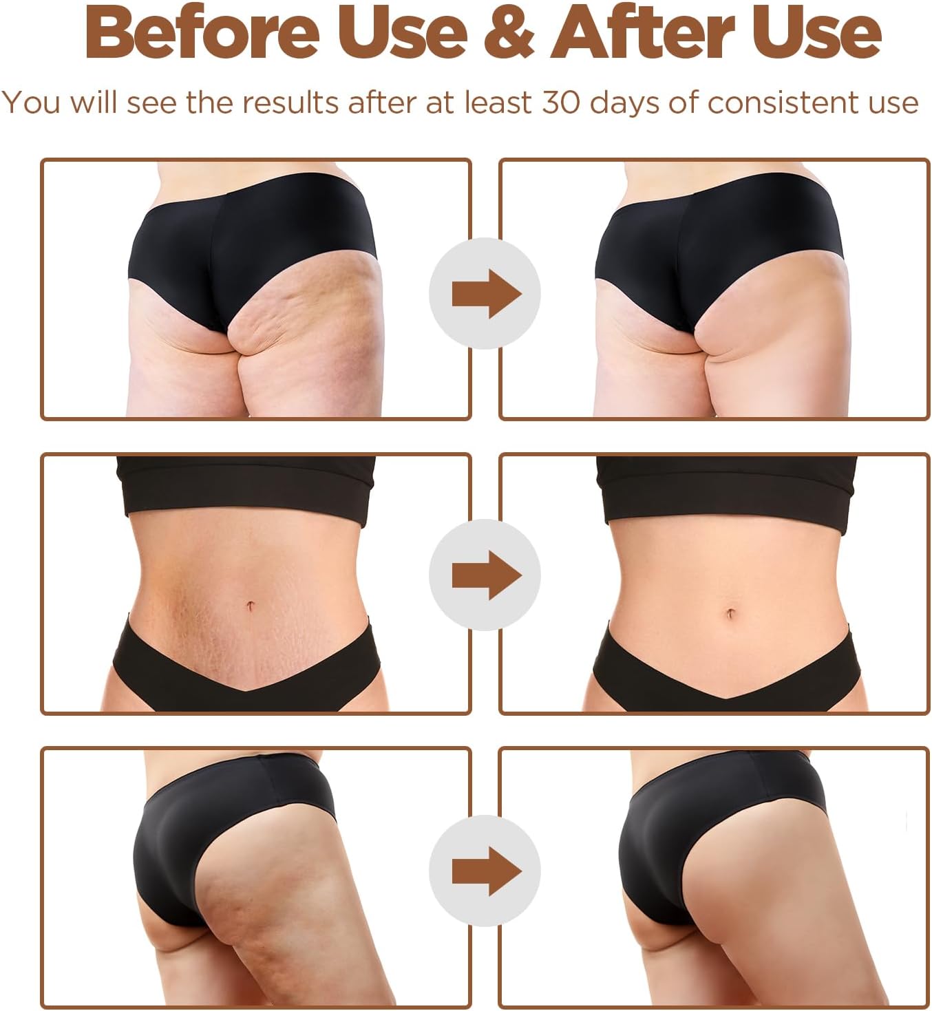 Thumbnail 3 de MYCARBON 3 in 1 Cupping Massager