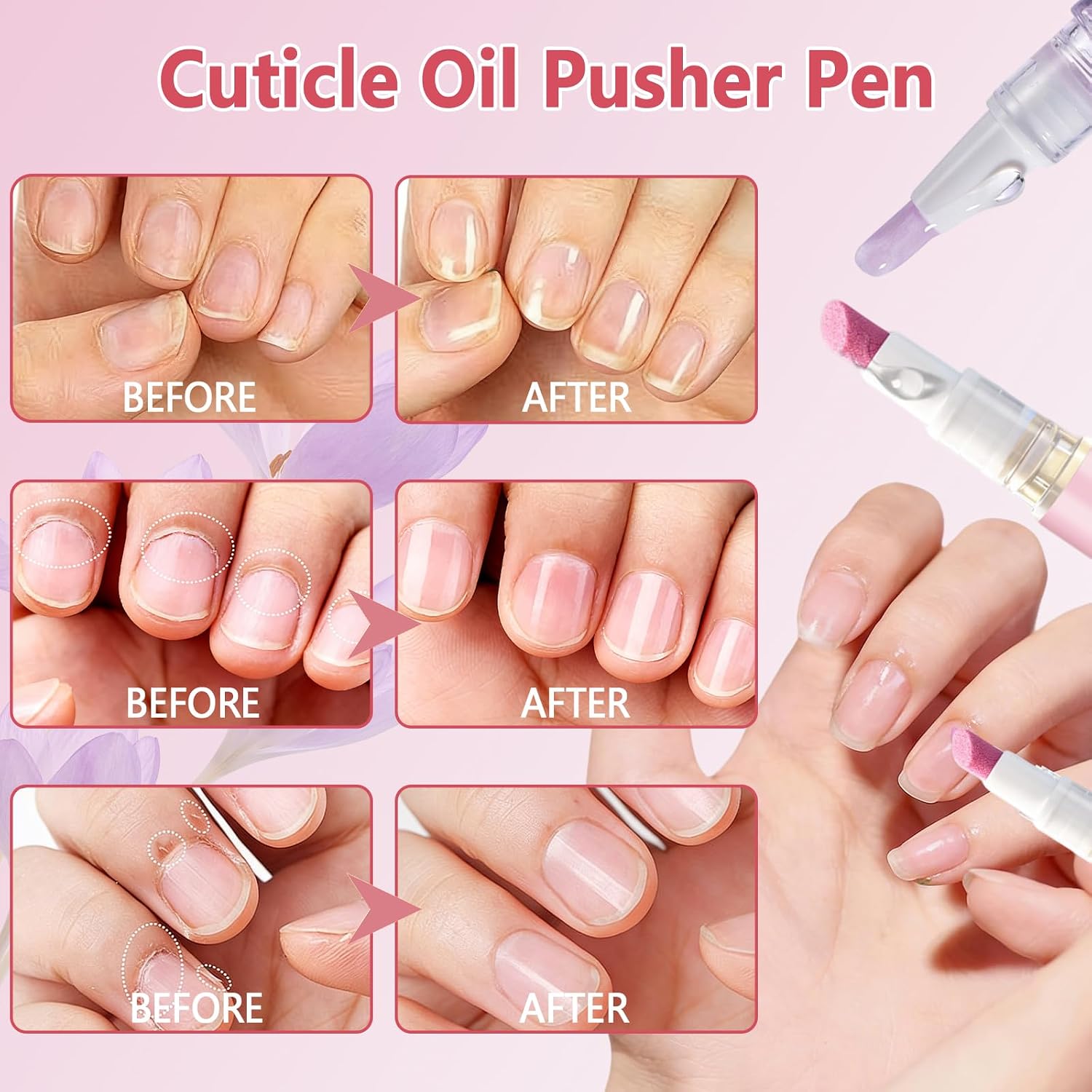Detalle de 2PCS Penna Spingi Cuticole 2 in 1 – Penna 3 in 1 con olio per cuticole