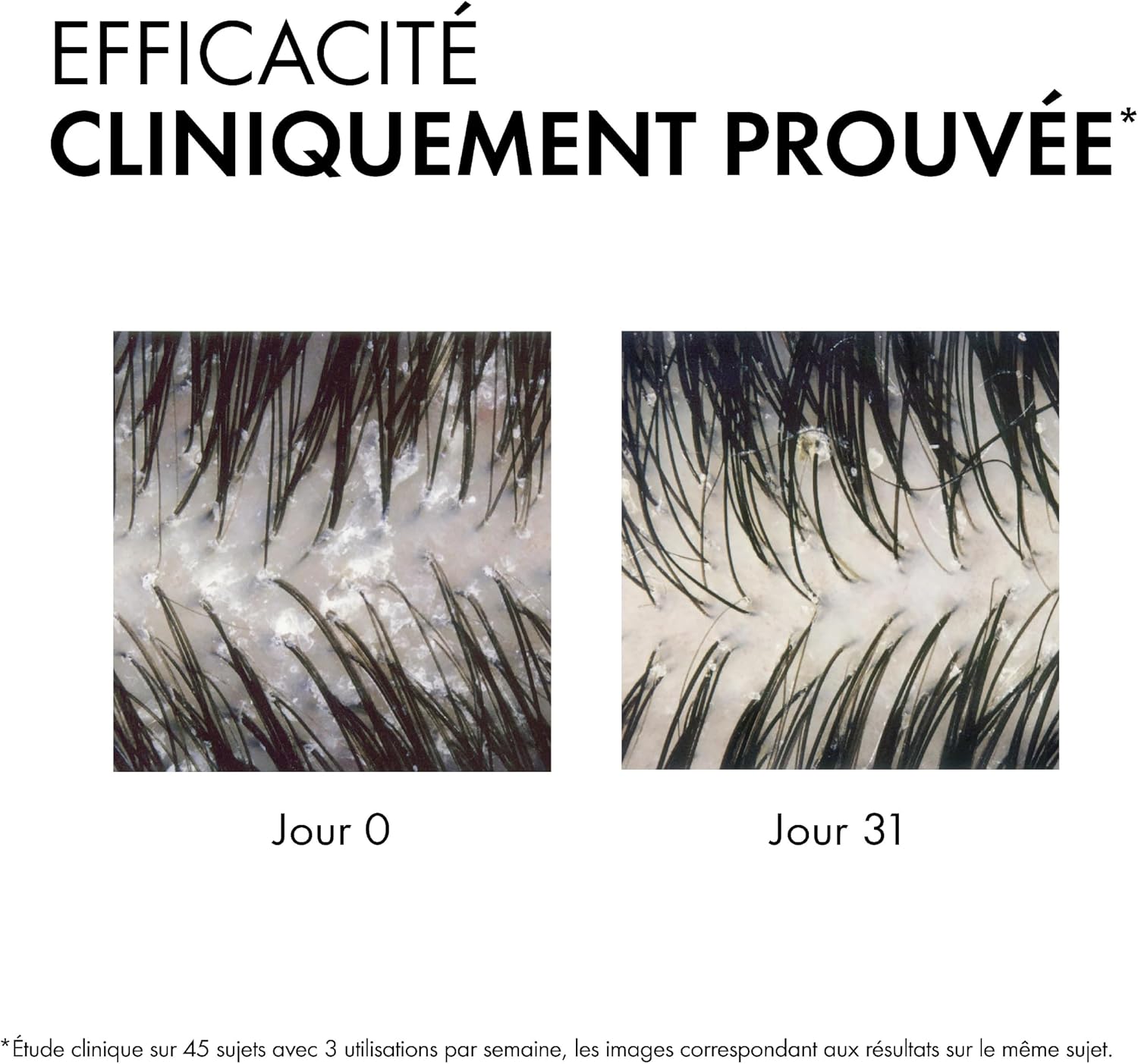 Detalle 2 de Vichy Dercos Shampooing Anti-Pelliculaire DS – Pour cheveux secs, Pellicules et Démangeaisons