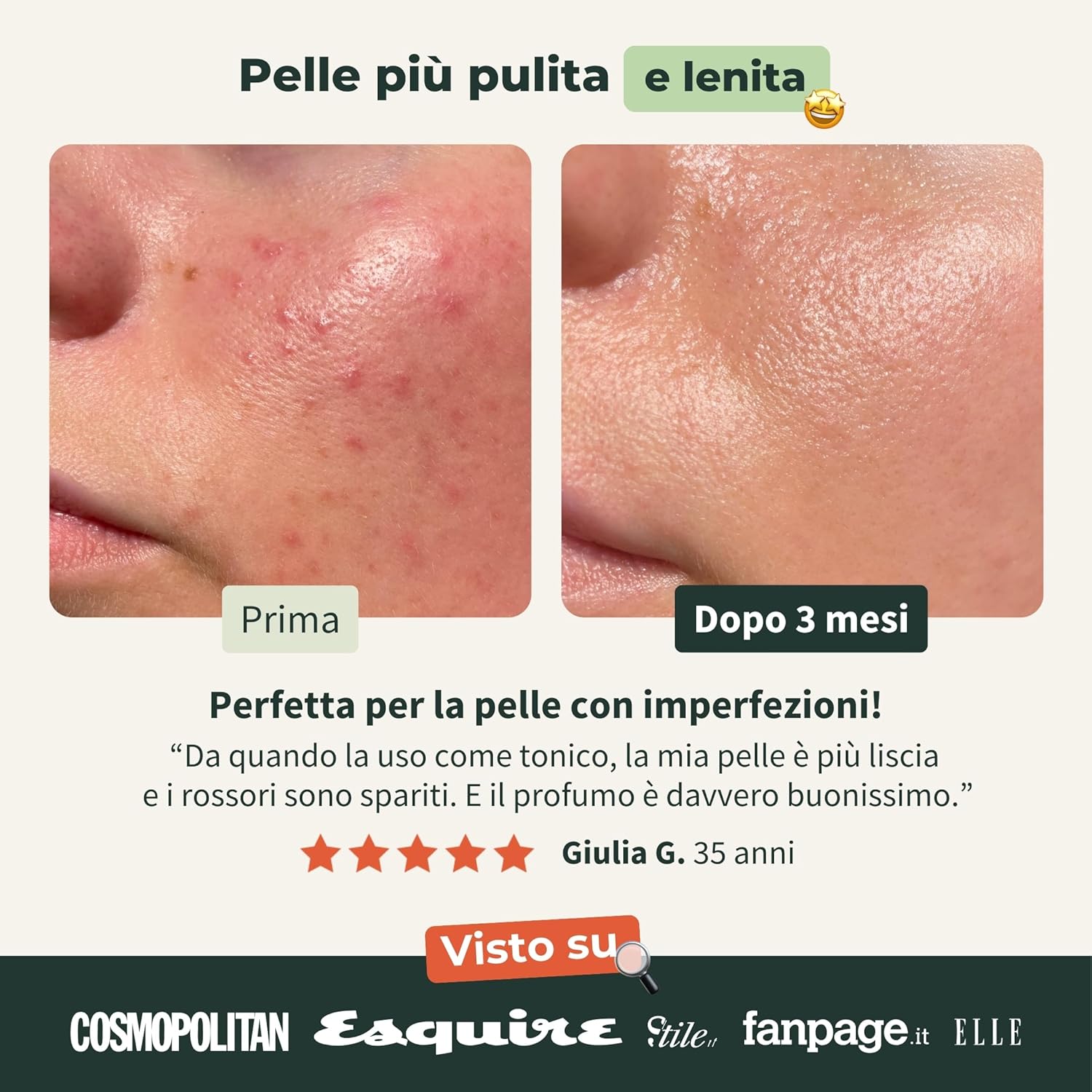 Detalle 2 de BIONOBLE Idrolato di Lavanda Bio: idrolato 100% naturale in sprays di vetro da 200 ml