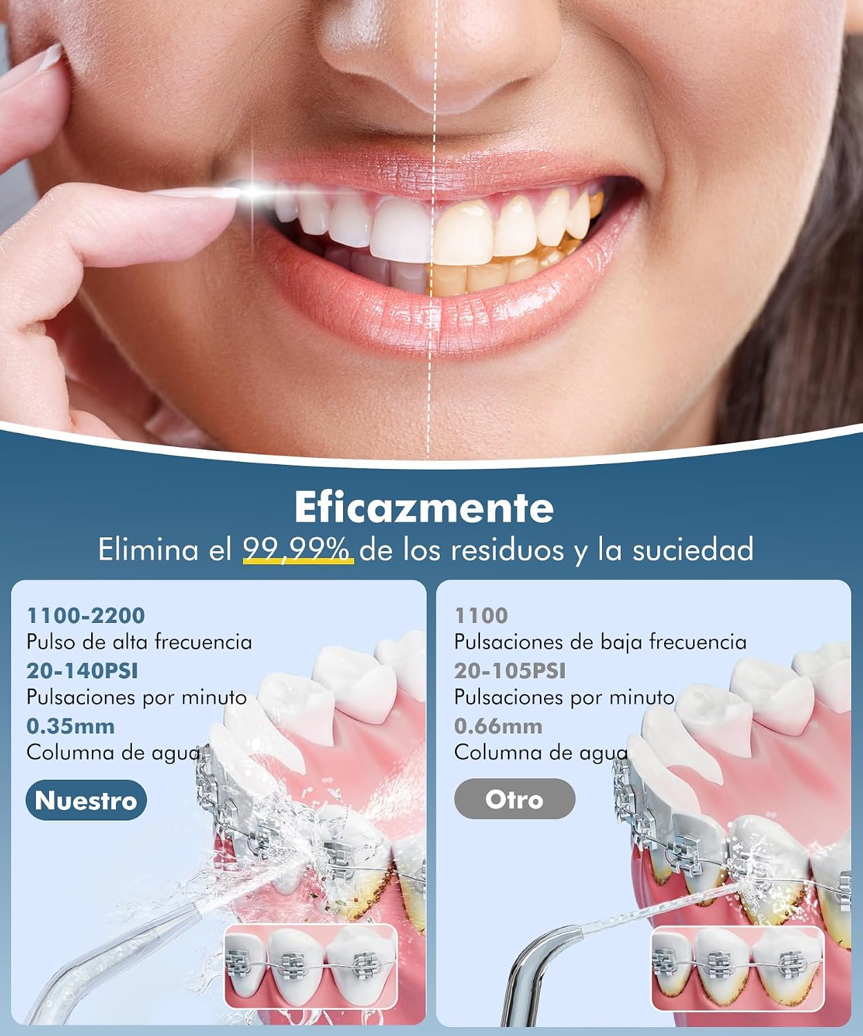Detalle 2 de ETROBOT Irrigador Dental Portátil 260 ml
