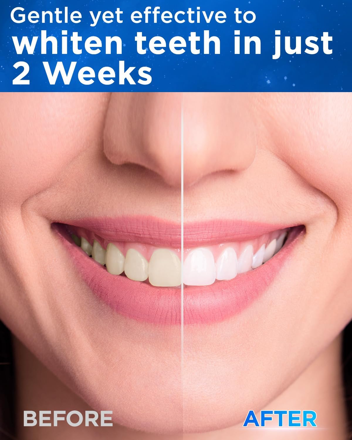 Detalle 1 de Sonic Electric Toothbrush 50,000 VPM 120 Days