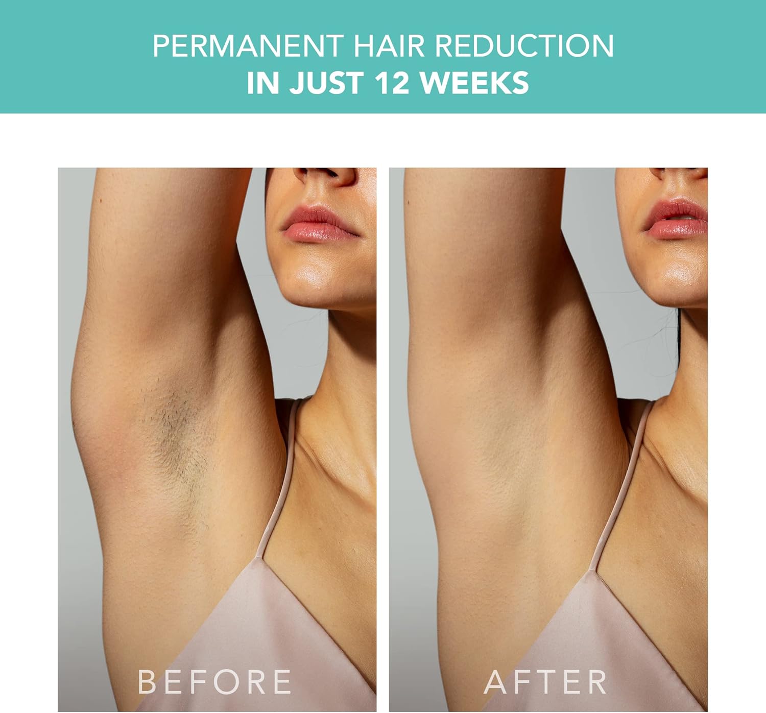Thumbnail 4 de FOREO PEACH 2 IPL Hair Removal Device (Mint) for smooth skin at home