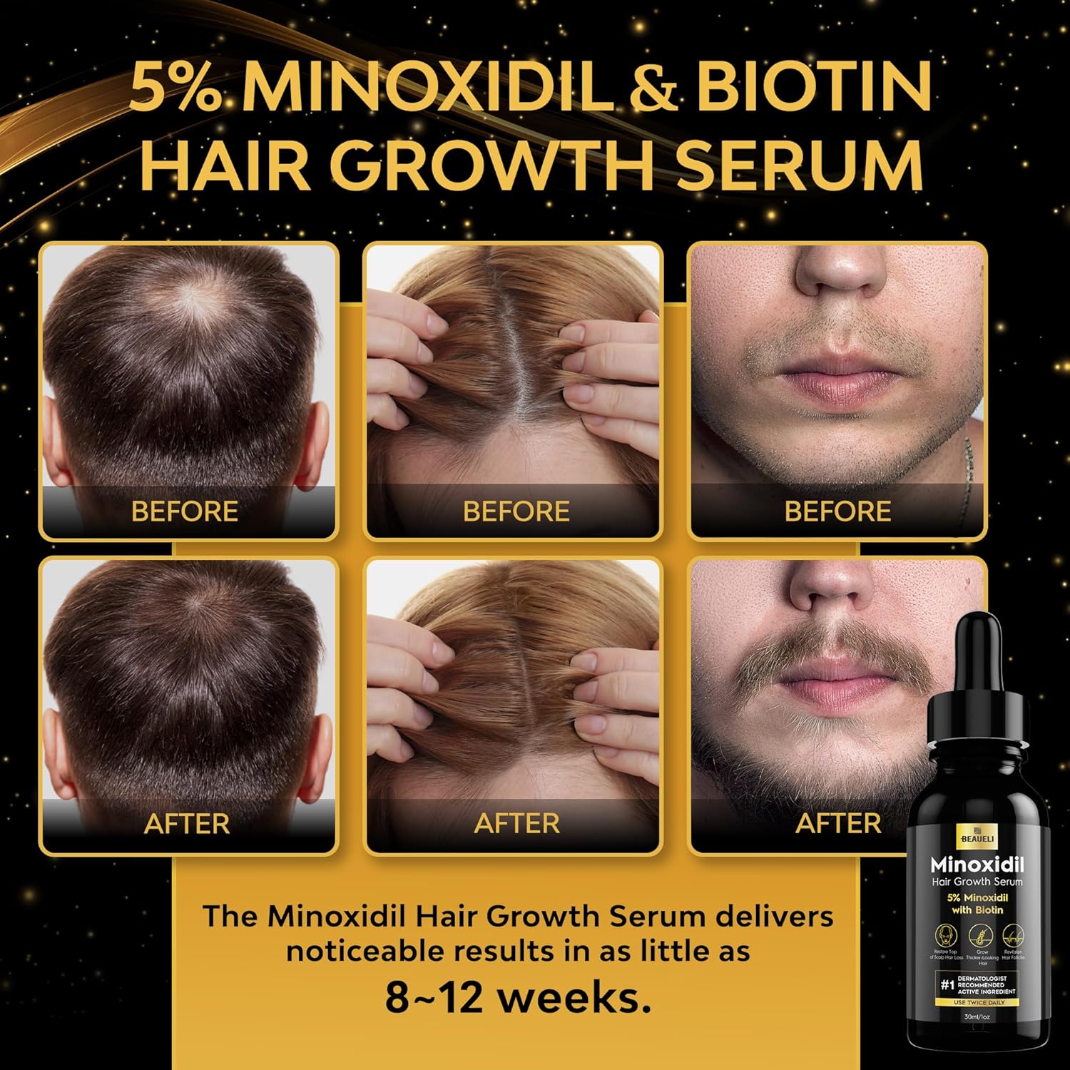 Detalle de Beaueli 5% Minoxidil for Men and Women (Unscented Drops, 3 Fl Oz, 3 Bottles) for Hair & Beard Growth