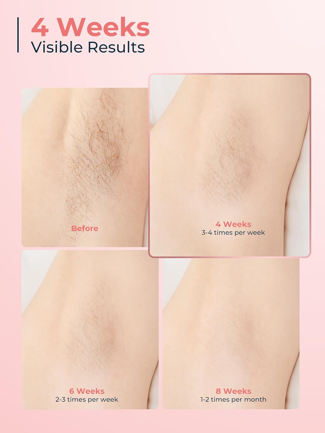 Thumbnail 3 de Beauris IPL Laser Hair Removal 21J device