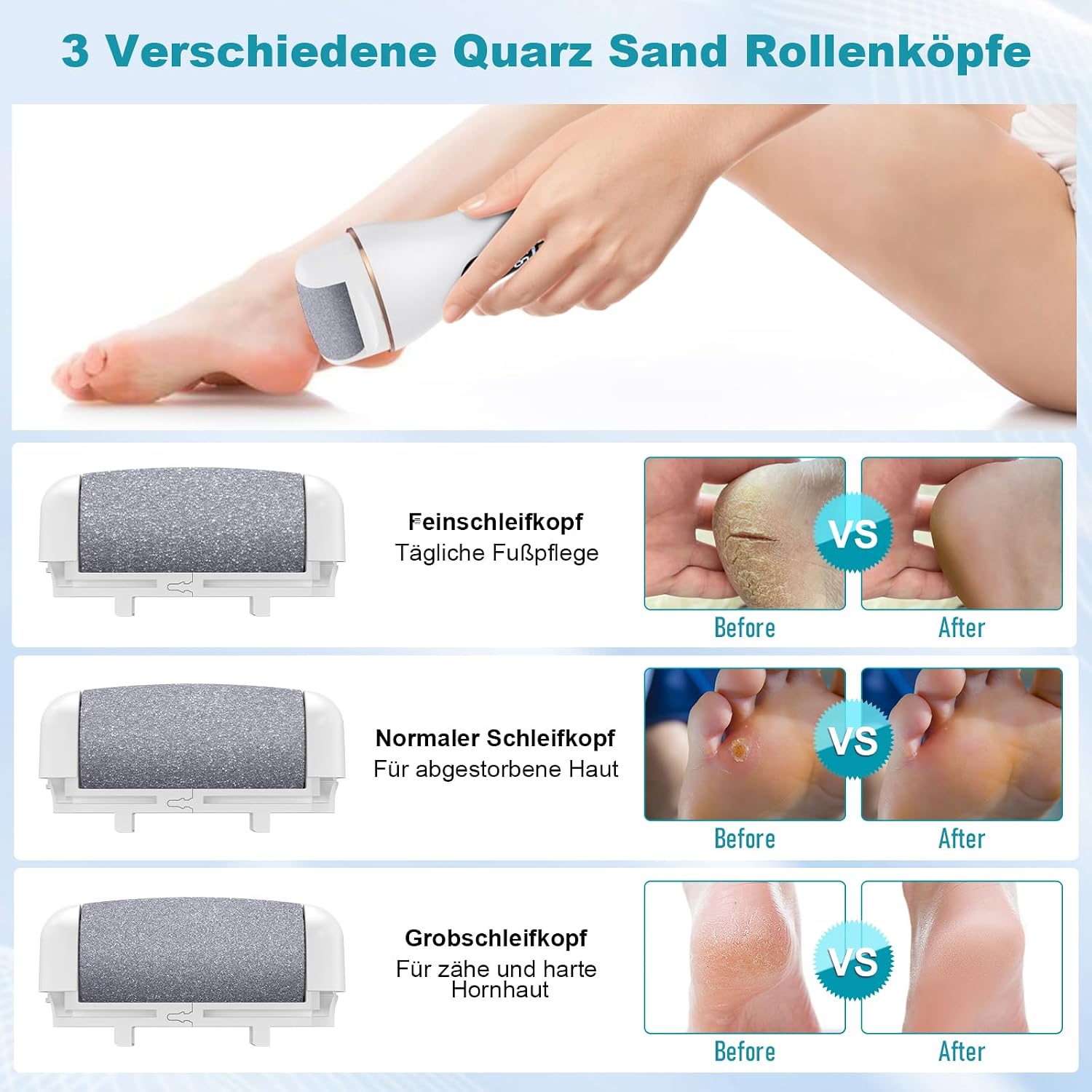 Detalle de Hornhautentferner Elektrisch – IPX7 Fußraspel mit 2 Geschwindigkeiten, USB-Aufladung und 19-in-1 Zubehör