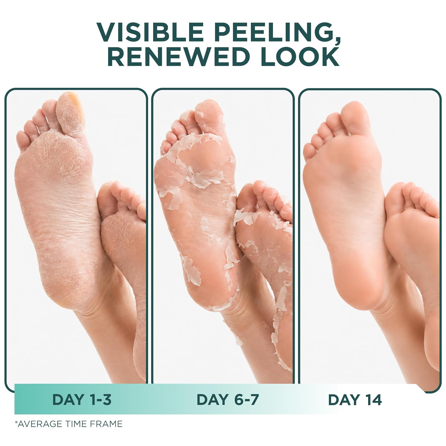 Thumbnail 1 de DERMORA Foot Peel Mask for Soft Feet