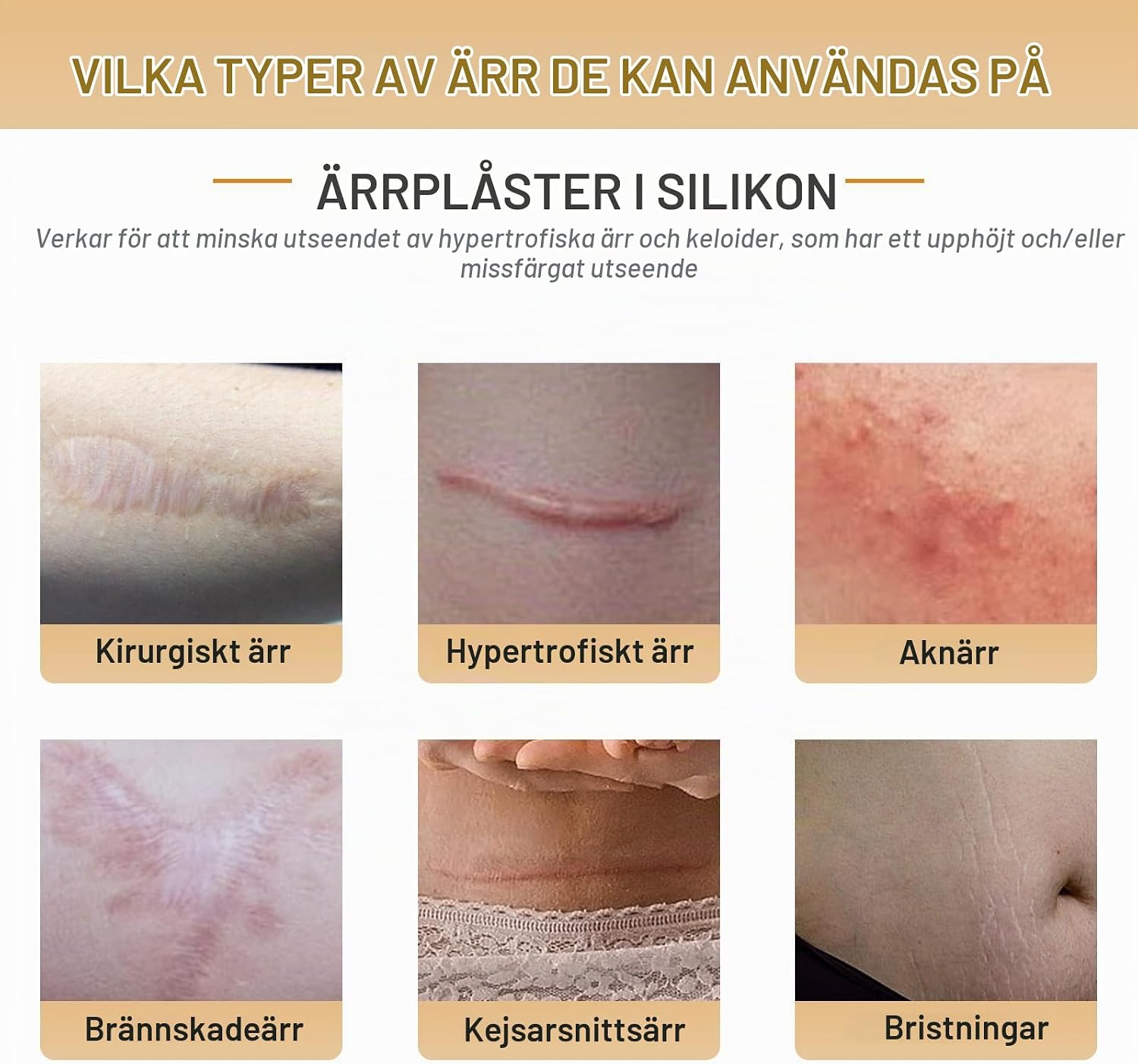 Detalle 2 de GTAGKOMMEN silikonärrtejp 4 cm x 300 cm – tvättbar och återanvändbar