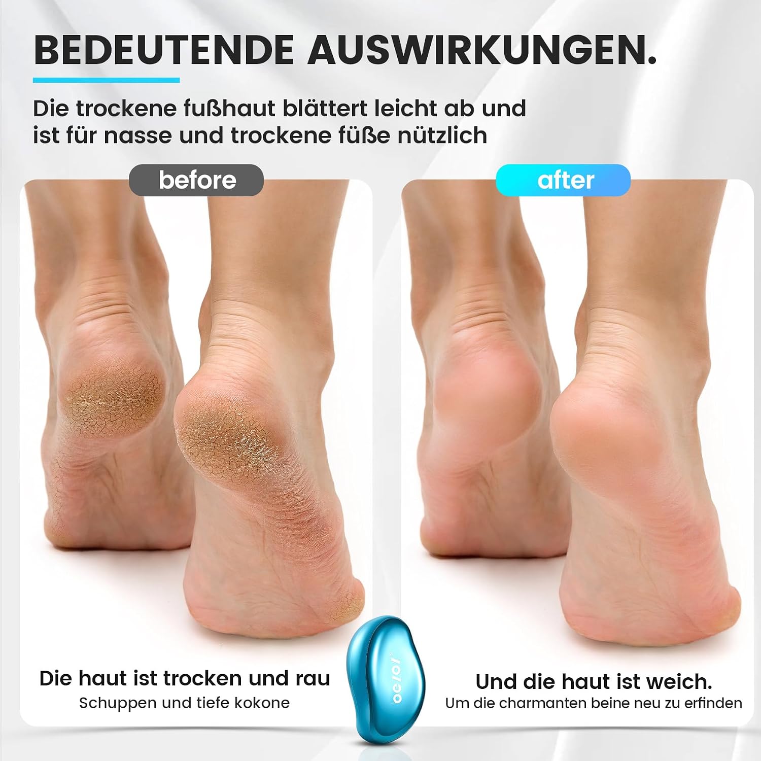 Detalle de BEZOX 2in1 Nano Glas Hornhautentferner – Premium Hornhautfeile