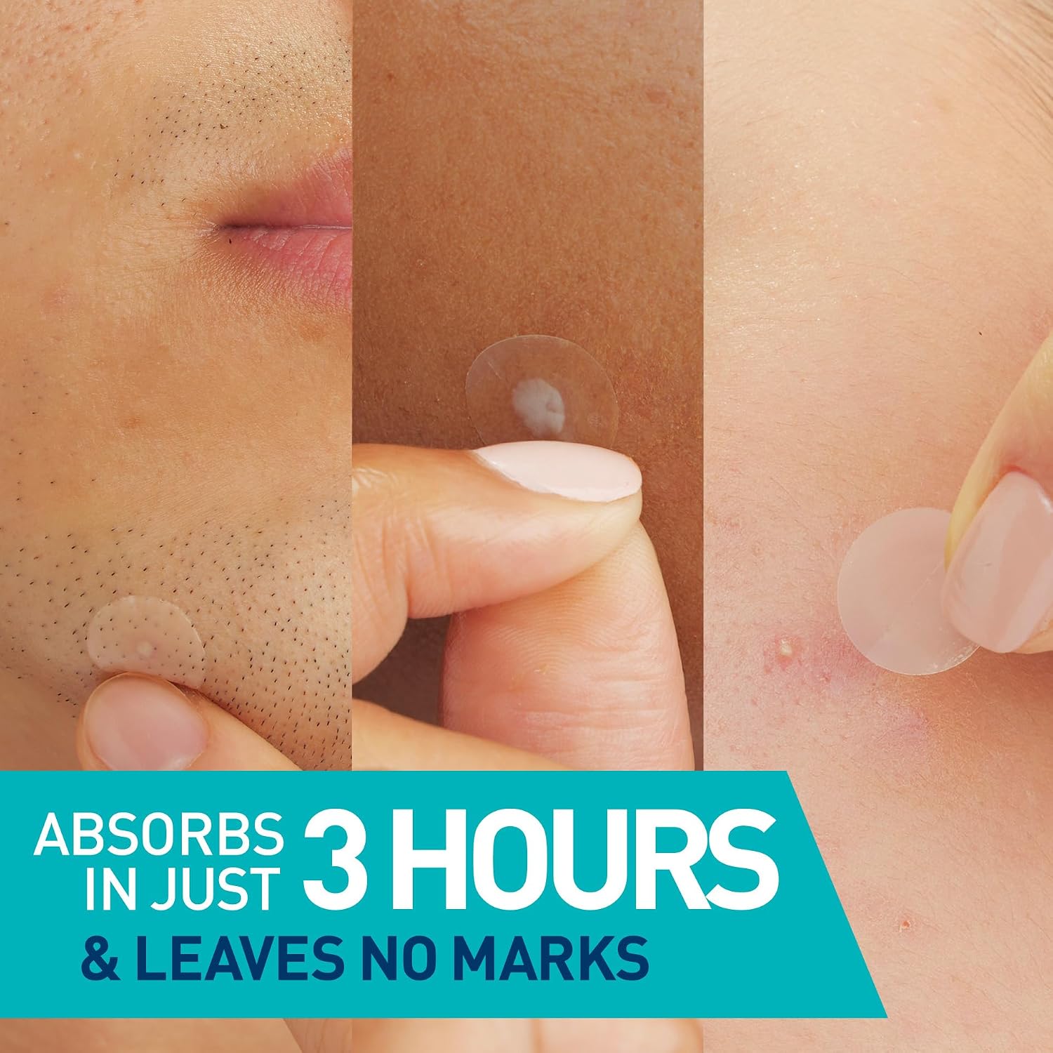 Detalle 2 de CeraVe Hydrocolloid Blemish Patches