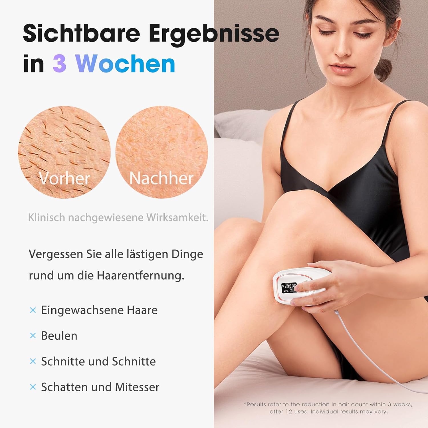 Detalle de Haarlosy IPL-Gerät zur Haarentfernung mit Kühlung und 5 Energiestufen