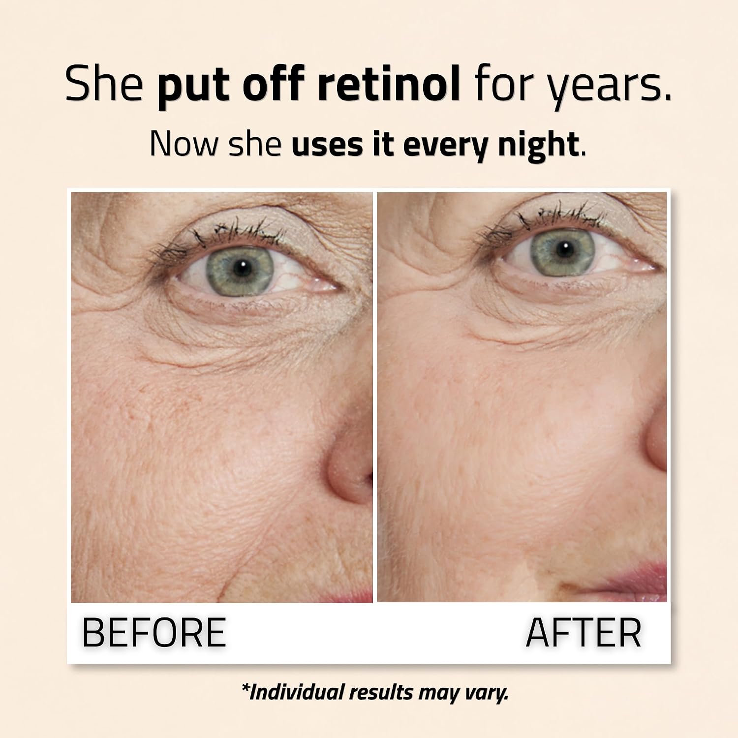 Detalle 2 de YEOUTH Retinolo Viso Siero 30 ml