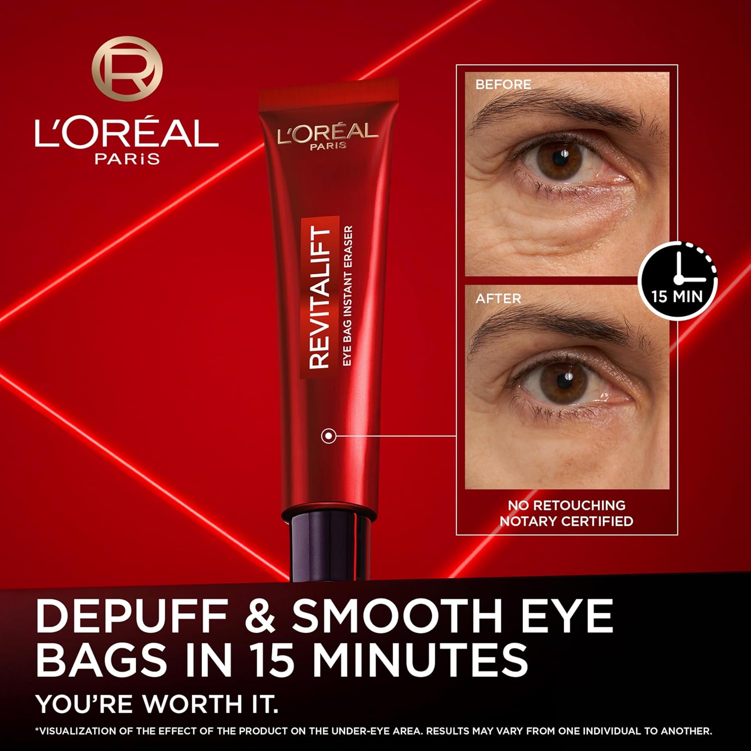 Detalle de L'Oréal Paris Eye Bag Eraser Under Eye Bag Treatment, Revitalift Laser, 10ml