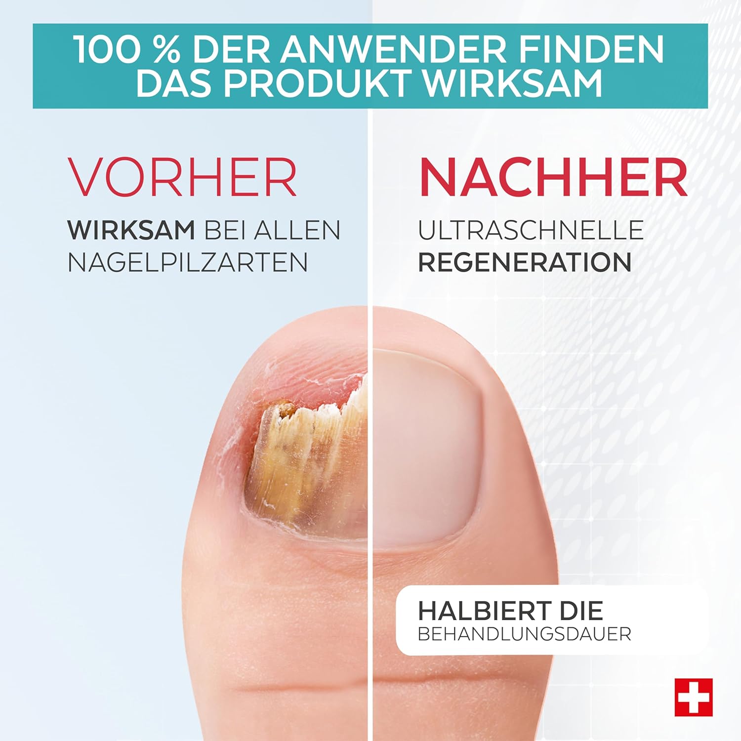 Detalle de PODERM BOOSTER Nagelpilz 100% 🦶