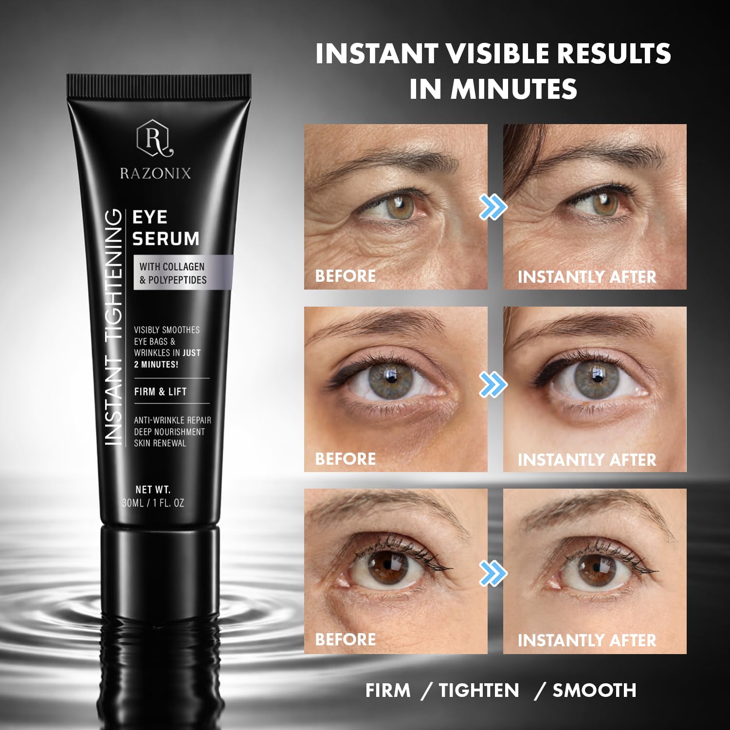 Thumbnail 2 de RAZONIX Instant Eye Tightening and Lifting Serum