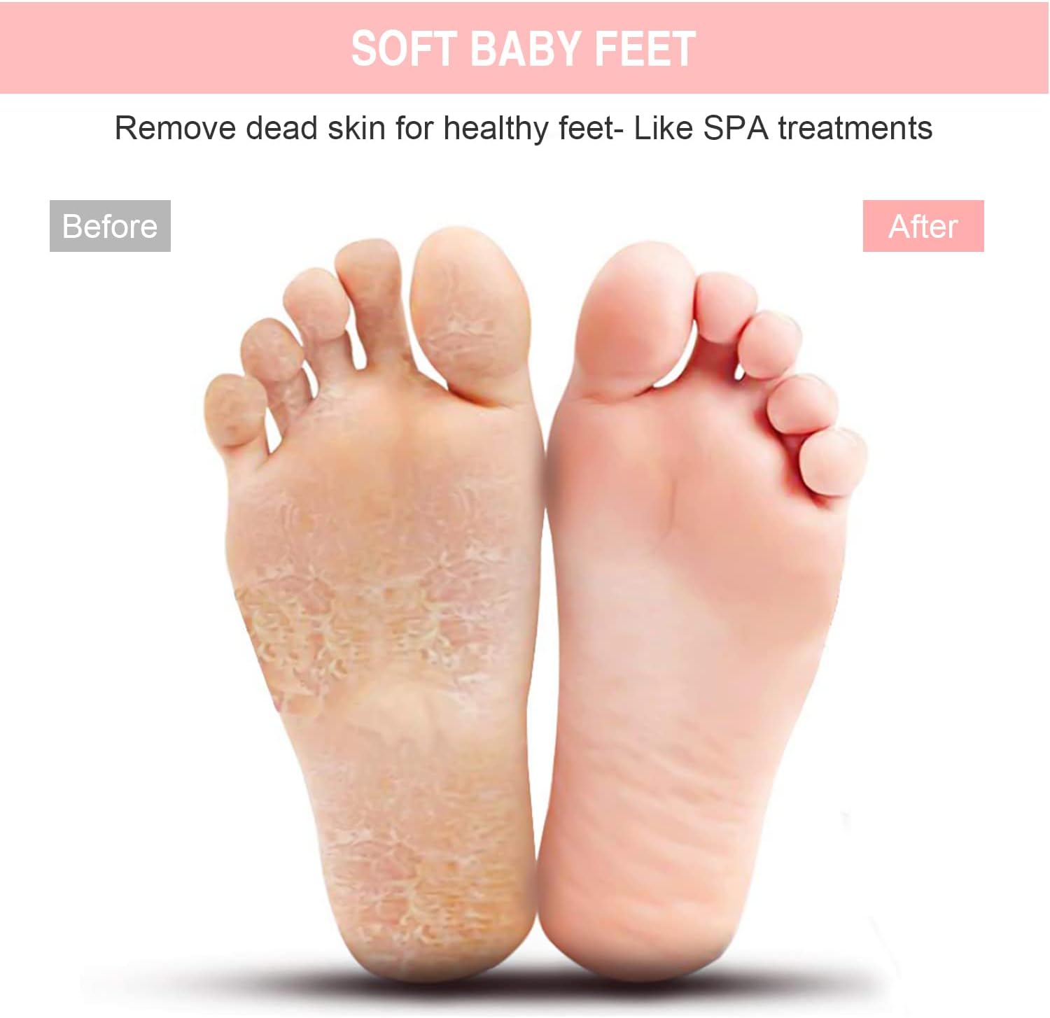 Thumbnail 2 de HONYIN Larger Foot Scrubber 28.4 x 28.4 cm