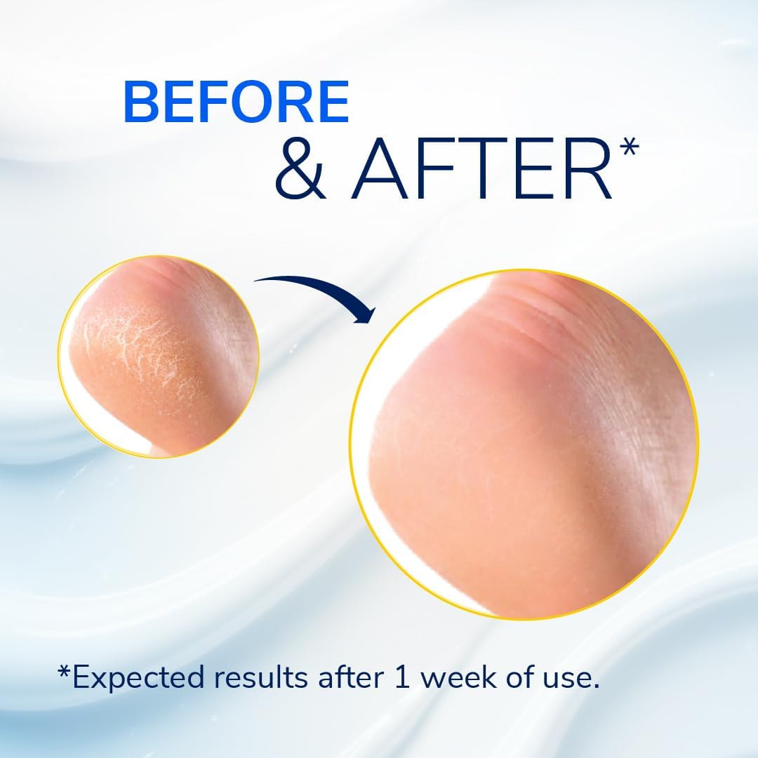 Detalle de Scholl Severe Cracked Heel Repair Balm 25% 🦶