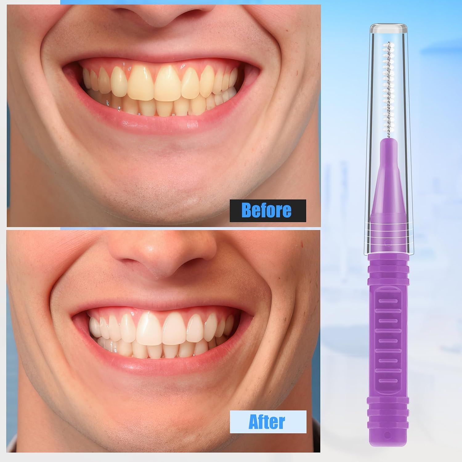 Detalle 2 de RAYITO 100 Interdental Brushes 5 sizes 🪥
