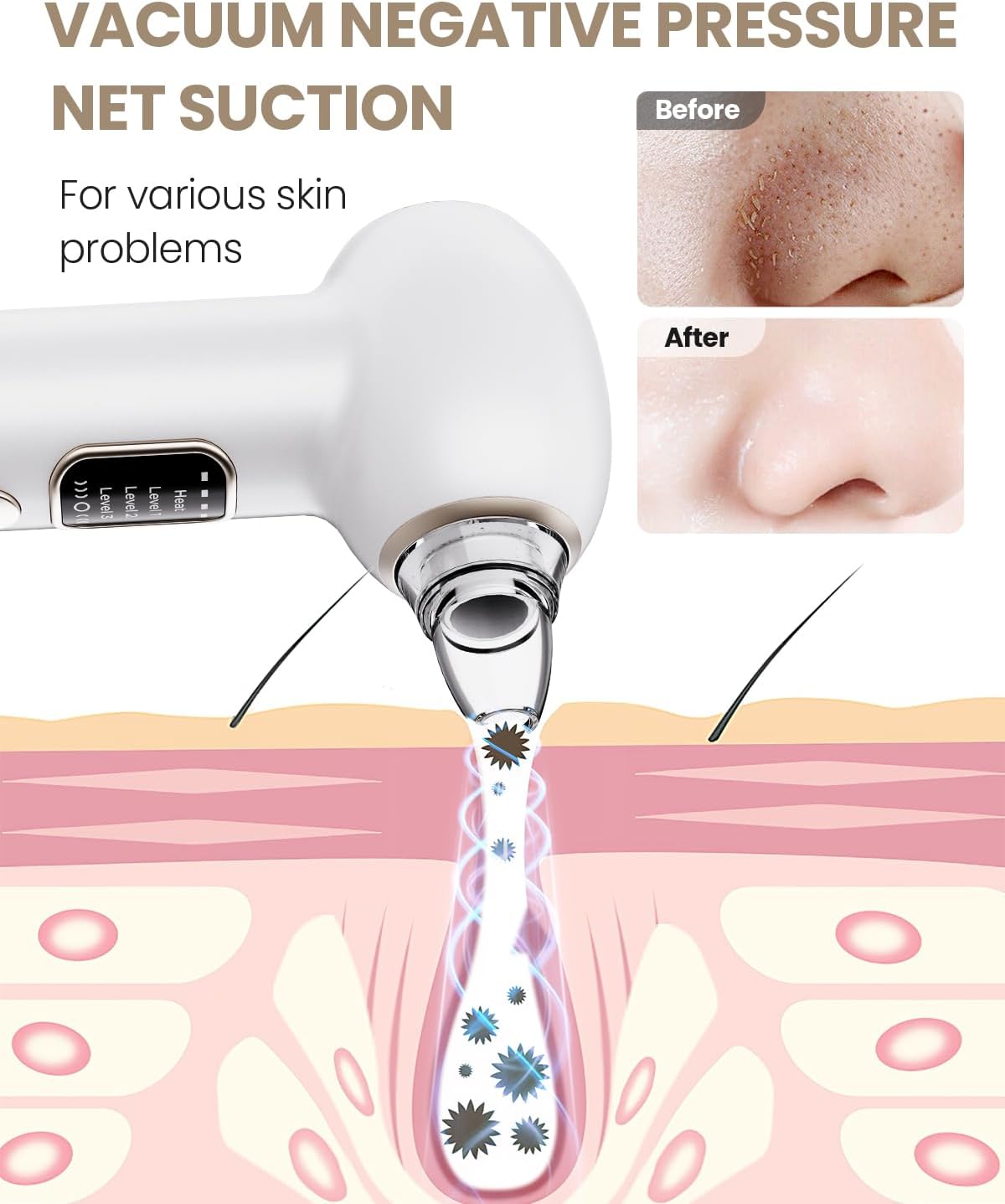 Detalle 2 de Heated Pore Vacuum with 5 Probes