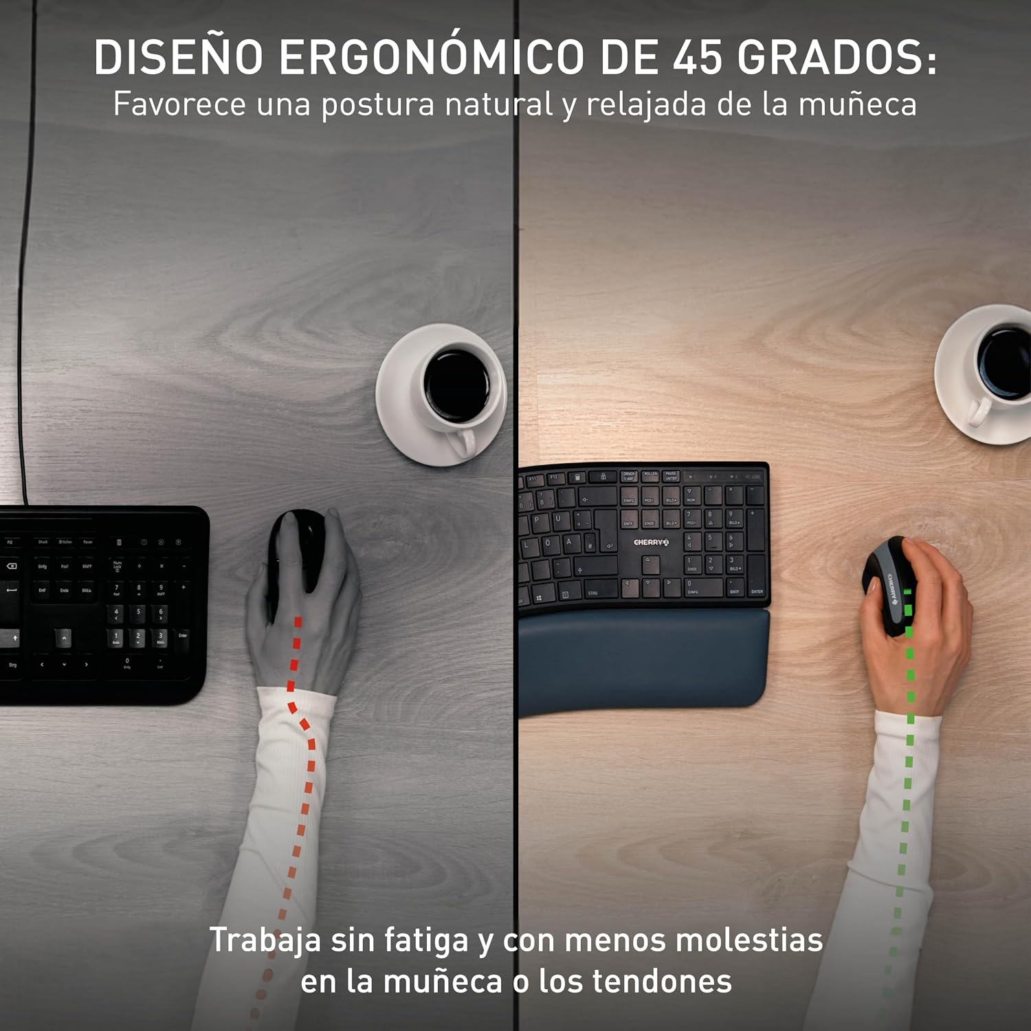 Detalle 2 de CHERRY MW 4500 🖱️ Ratón Vertical Ergonómico para Diestros