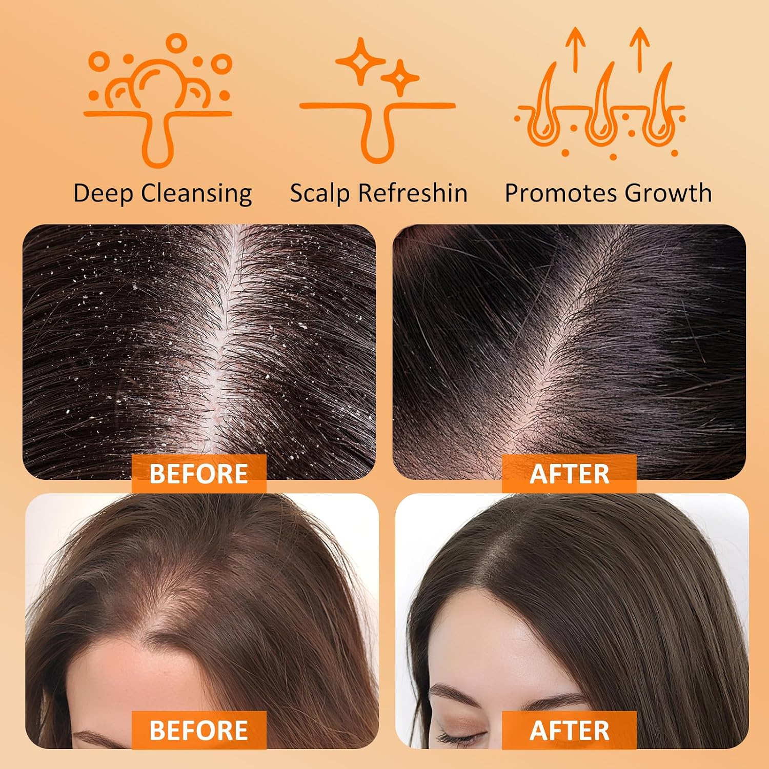 Thumbnail 4 de Scalp Scrub Pumpkin Seed Oil & Biotin, 8.8oz