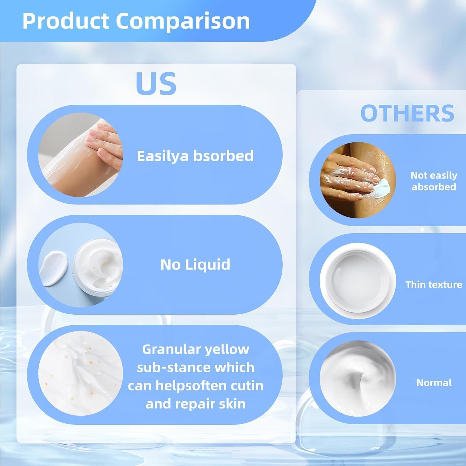 Detalle de QQWIAX 40% Urea Cream, 170 g for Dry, Rough Hands and Feet