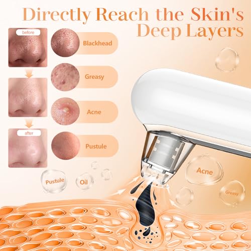 Detalle de Yccu Blackhead Remover Vacuum 4 Modes