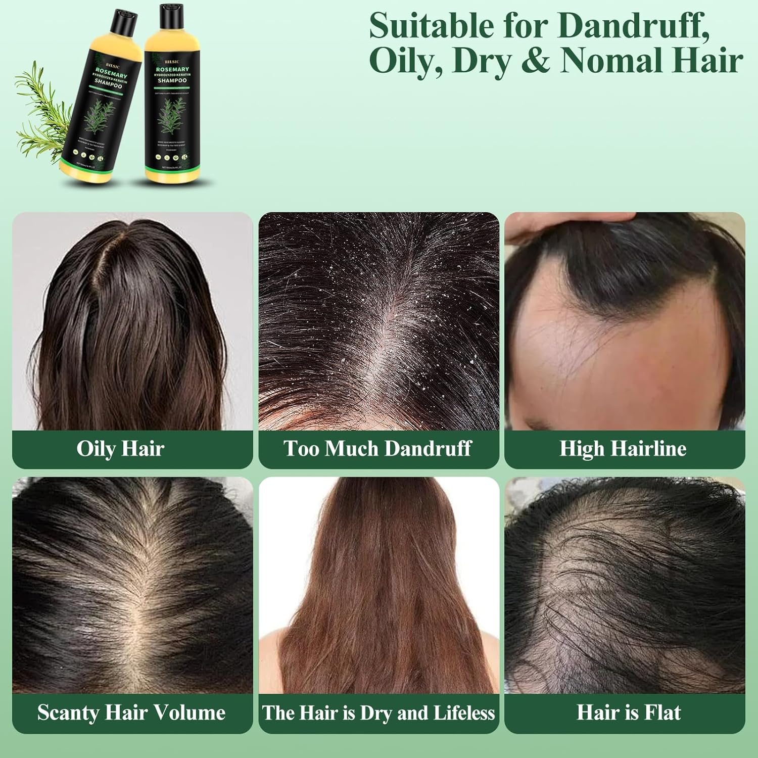 Detalle de Shampoo Rosmarino 500ML con Cheratina Idrolizzata – Benessere per Cuoio Capelluto e Capelli
