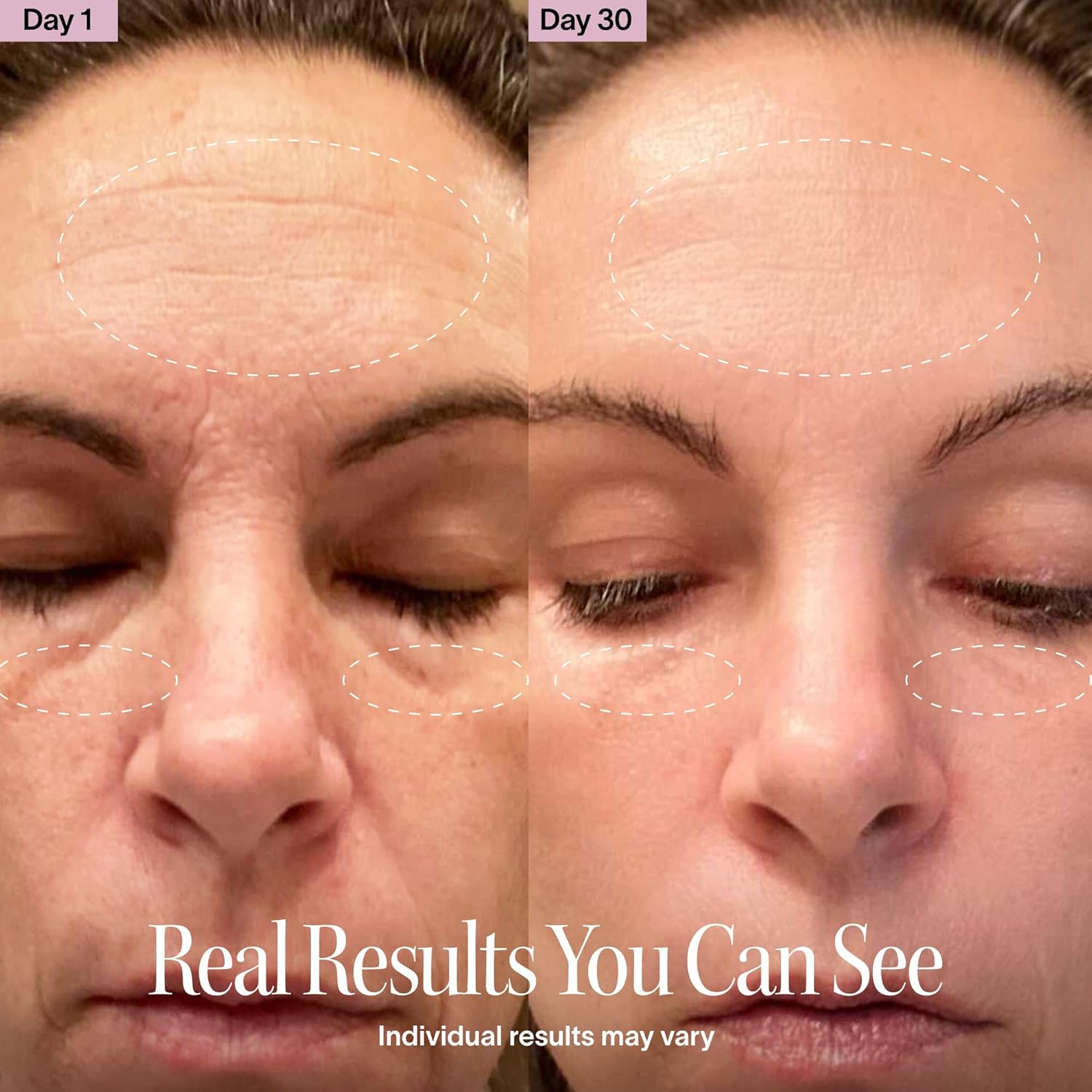 Thumbnail 3 de Solawave 4-in-1 Red Light Wand 3 min