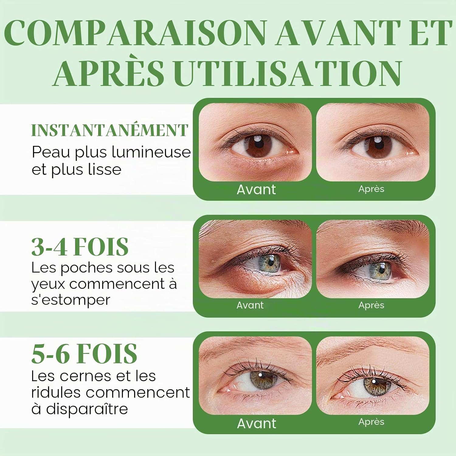 Detalle de Lot de 60 coussinets contour des yeux à l’aloe vera – Masque hydrogel hydratant 80 g