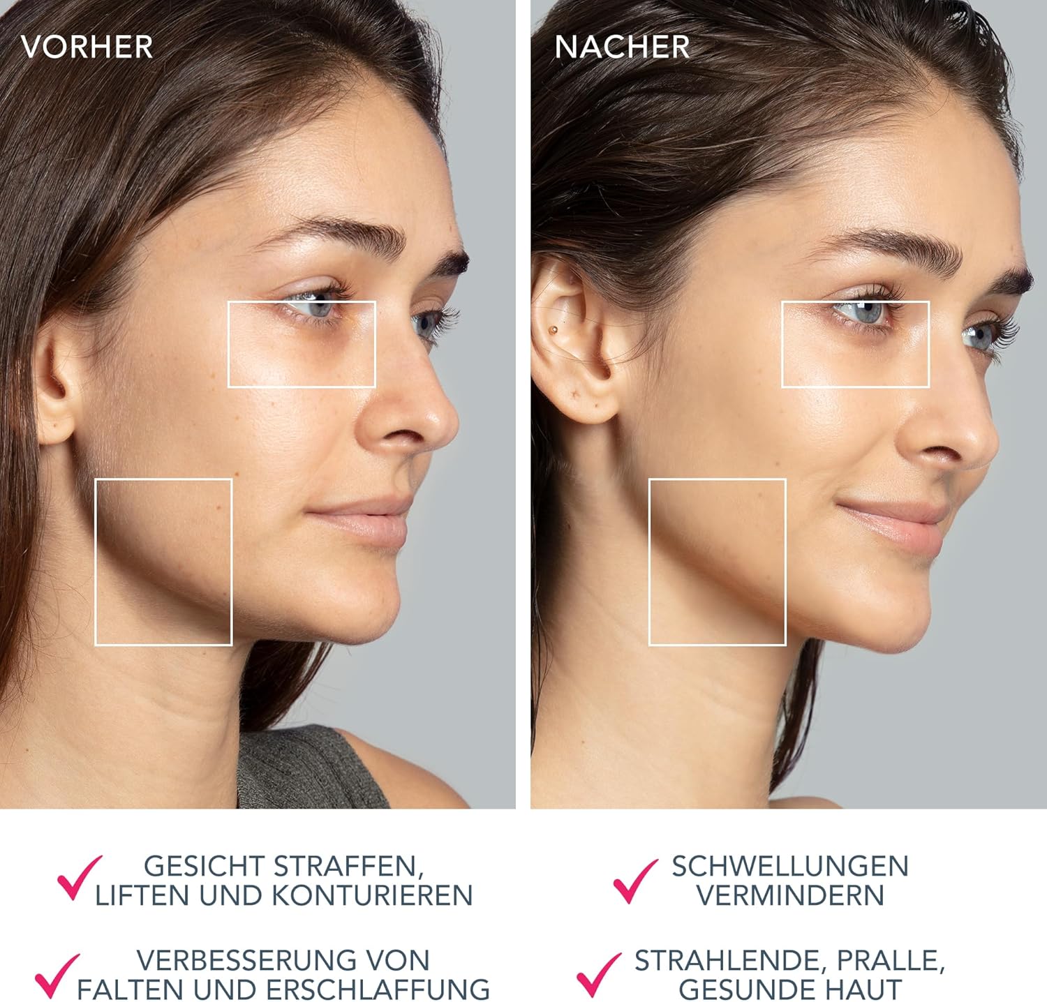 Thumbnail 4 de FOREO Total Facelift Set mit BEAR 2 Mikrostromgerät, SUPERCHARGED Serum 2.0 (30 ml) & HA+PGA Intensivpflege (50 ml) – Anti-Aging