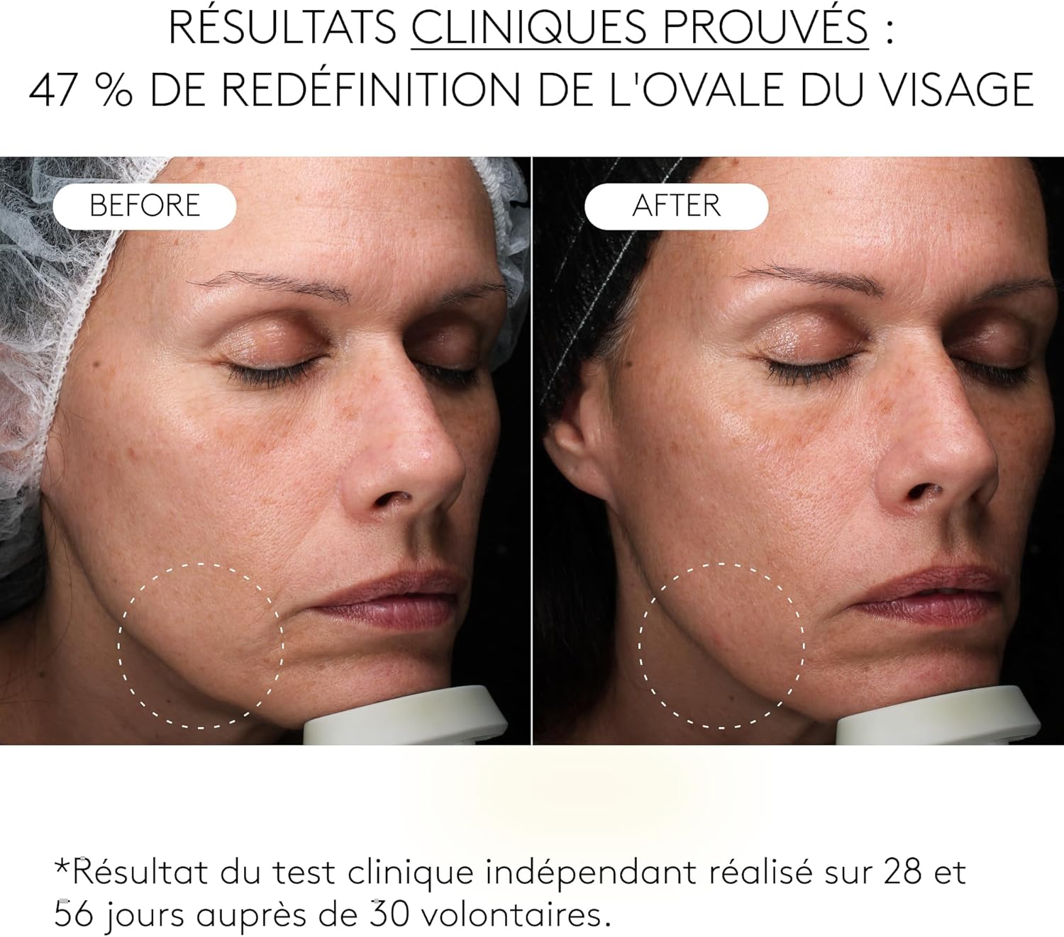 Thumbnail 4 de COCUNAT Sérum exosomes V-LIFTING 30 ml