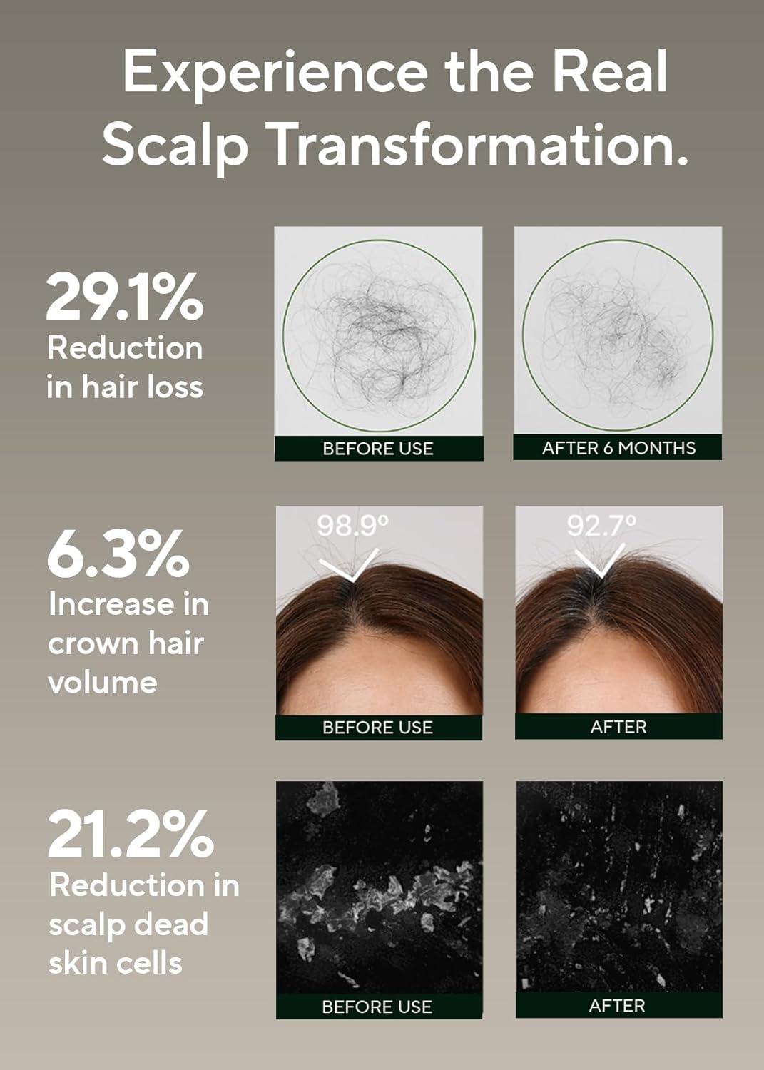 Detalle de AROMATICA Shampoo Scrub al Sale di Rosmarino 300 g – Esfolia e contrasta la caduta dei capelli