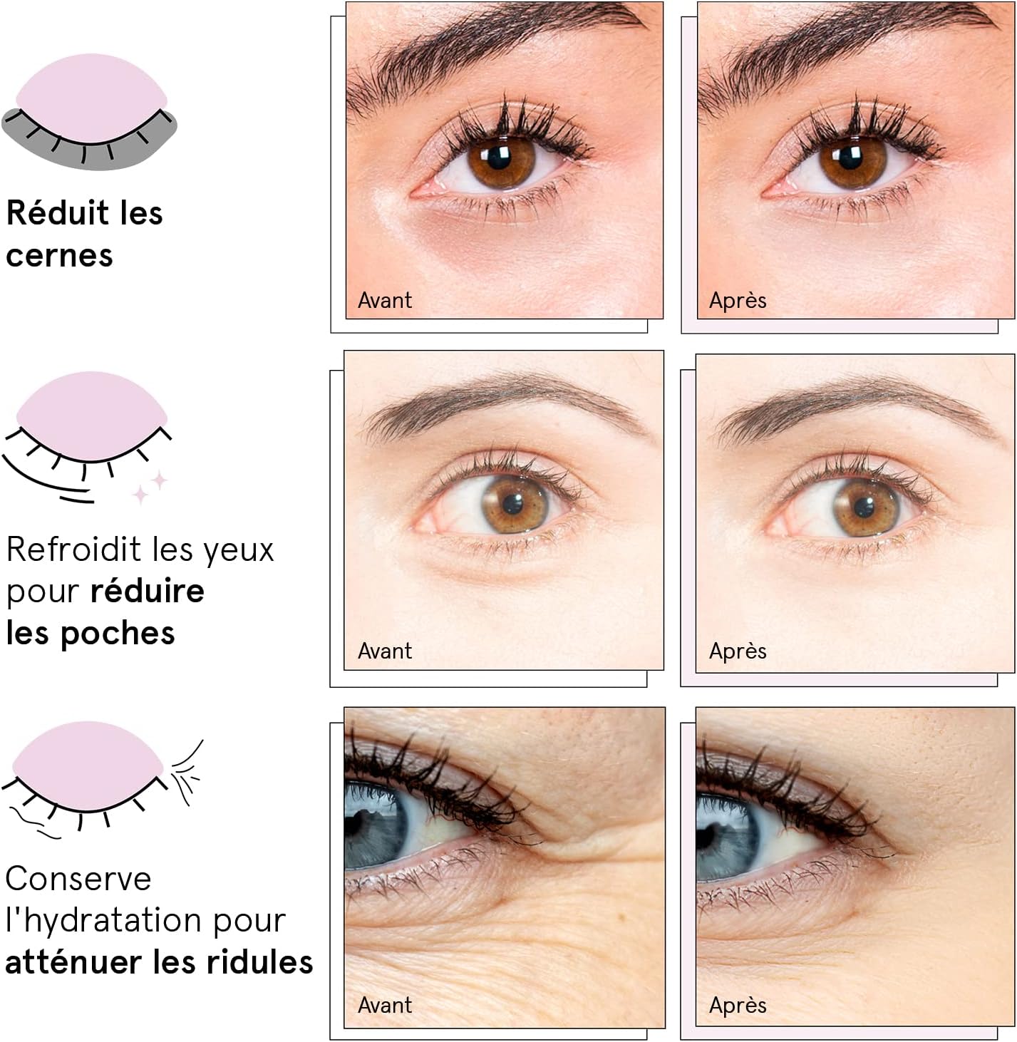 Thumbnail 2 de grace & stella Patch Yeux Anti Cernes à la Caféine (niacinamide & acide hyaluronique) – 24 paires, blanc