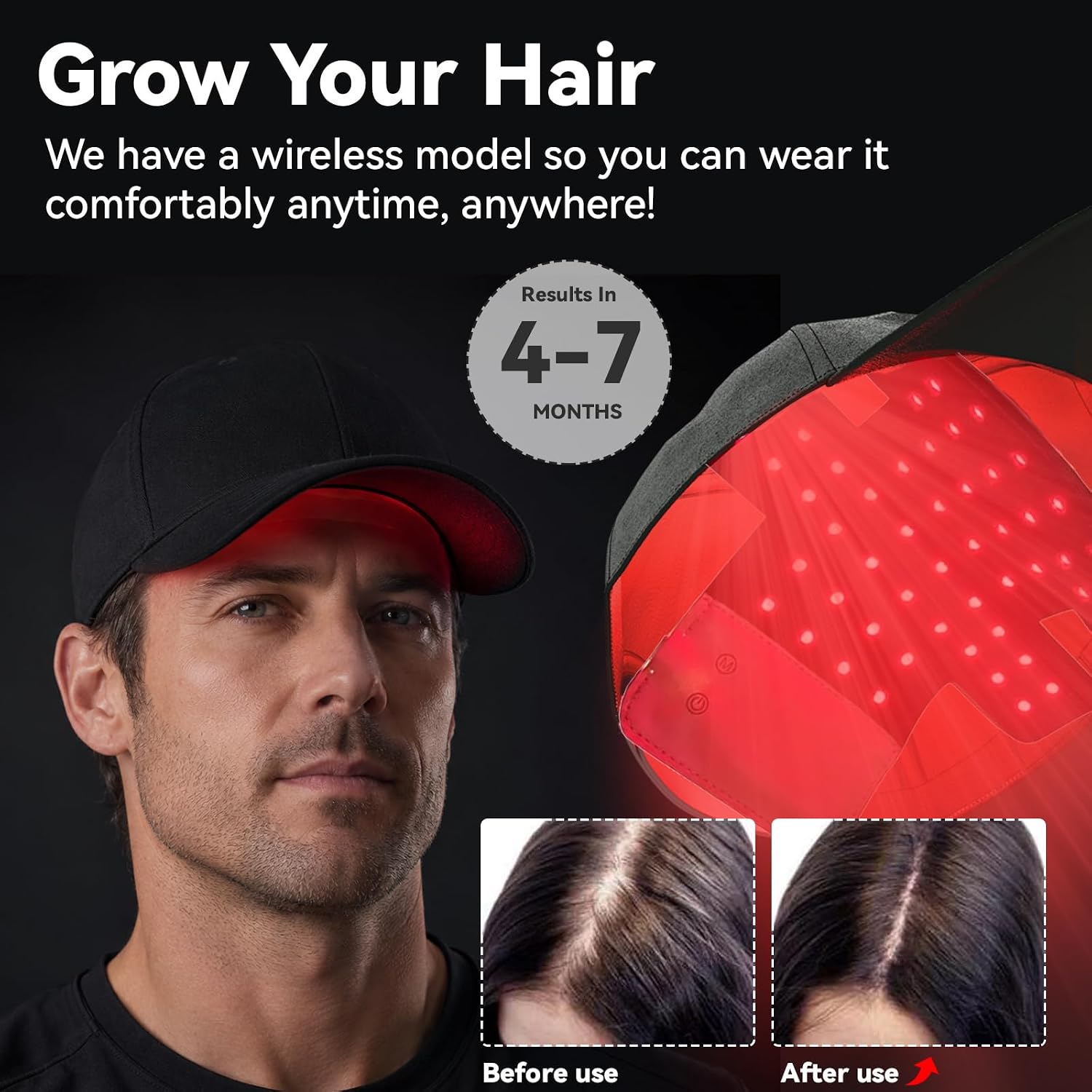 Detalle 2 de Generic LED Hair Therapy Cap with Red, Infrared and Blue Light