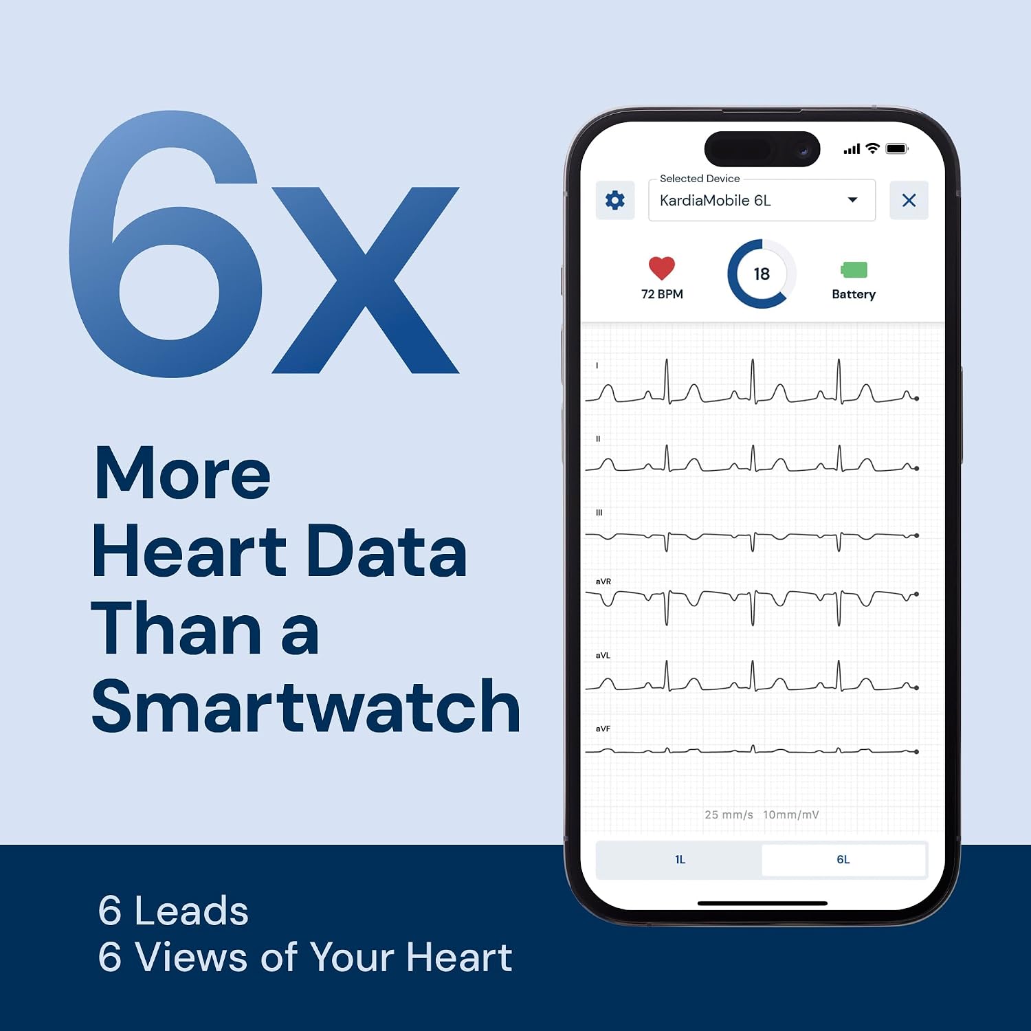 Detalle 2 de KardiaMobile 6L EKG Monitor