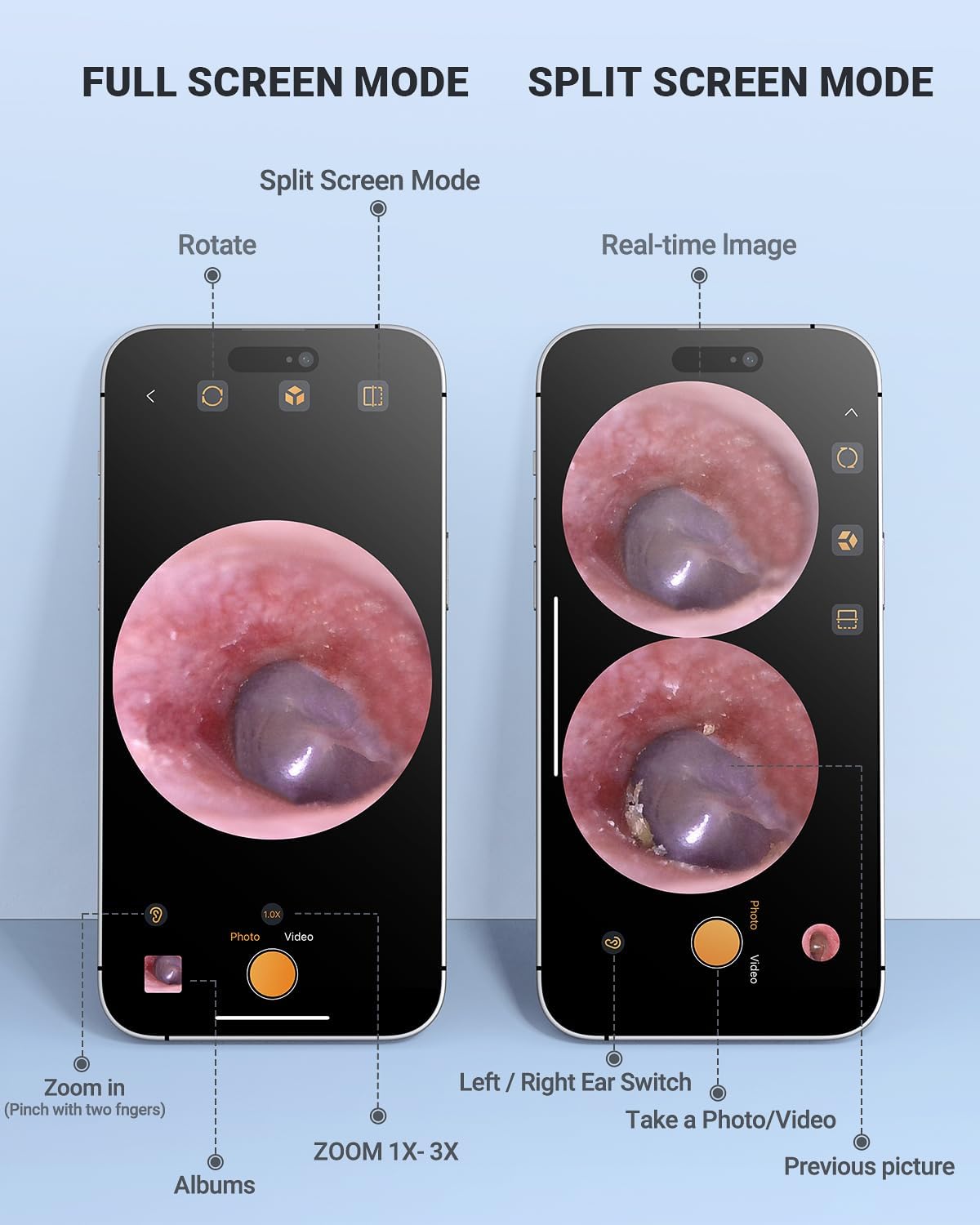 Detalle de AnyScope Digital Otoscope for iPhone & Android, 3.9 mm Camera, 6 LEDs