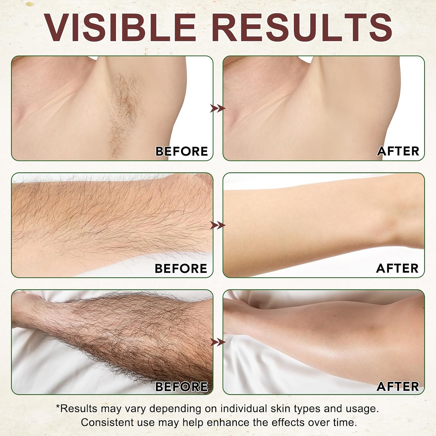 Thumbnail 5 de Cyperus Rotundus Oil for Hair Removal: Natural Option for Smoother Skin