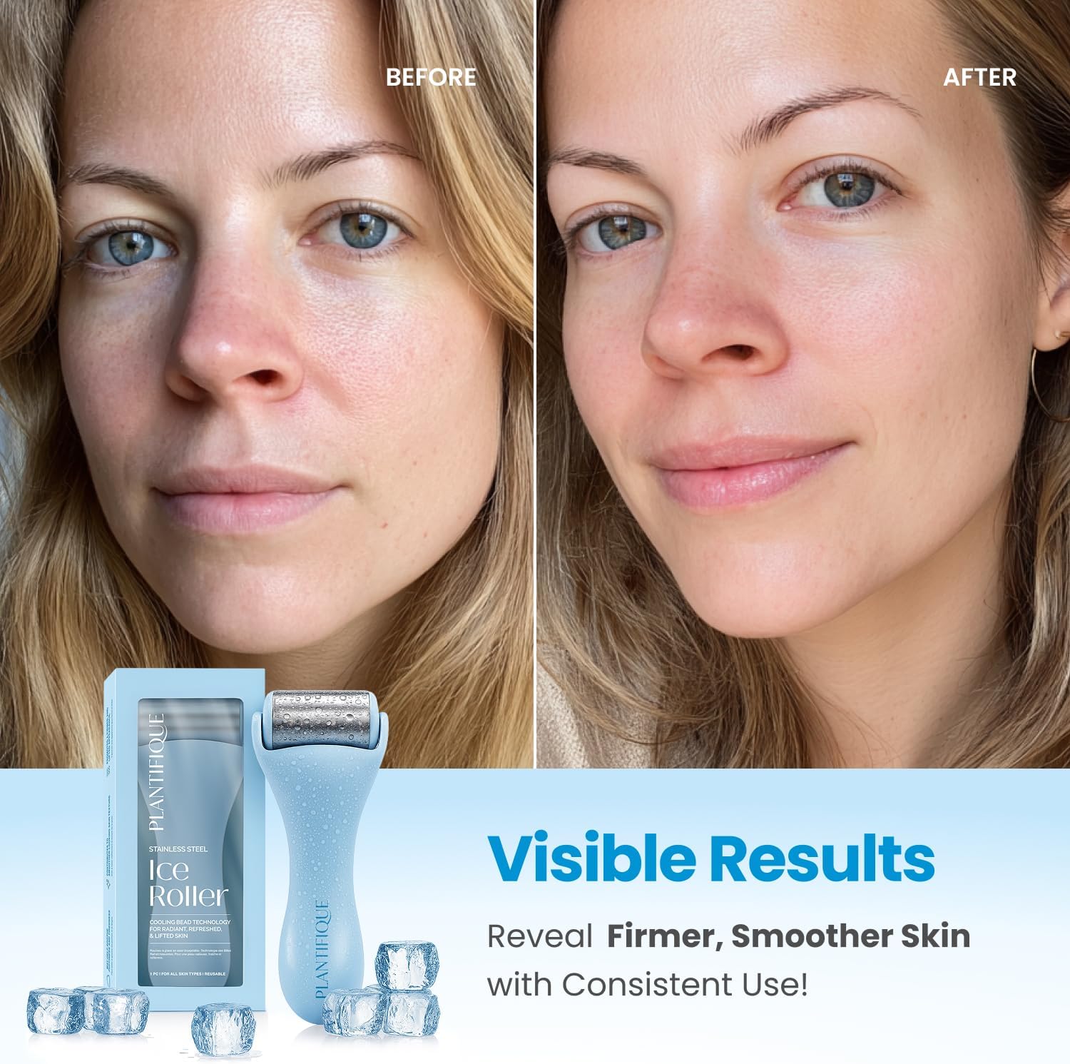 Thumbnail 1 de PLANTIFIQUE Facial Ice Roller for Puffiness
