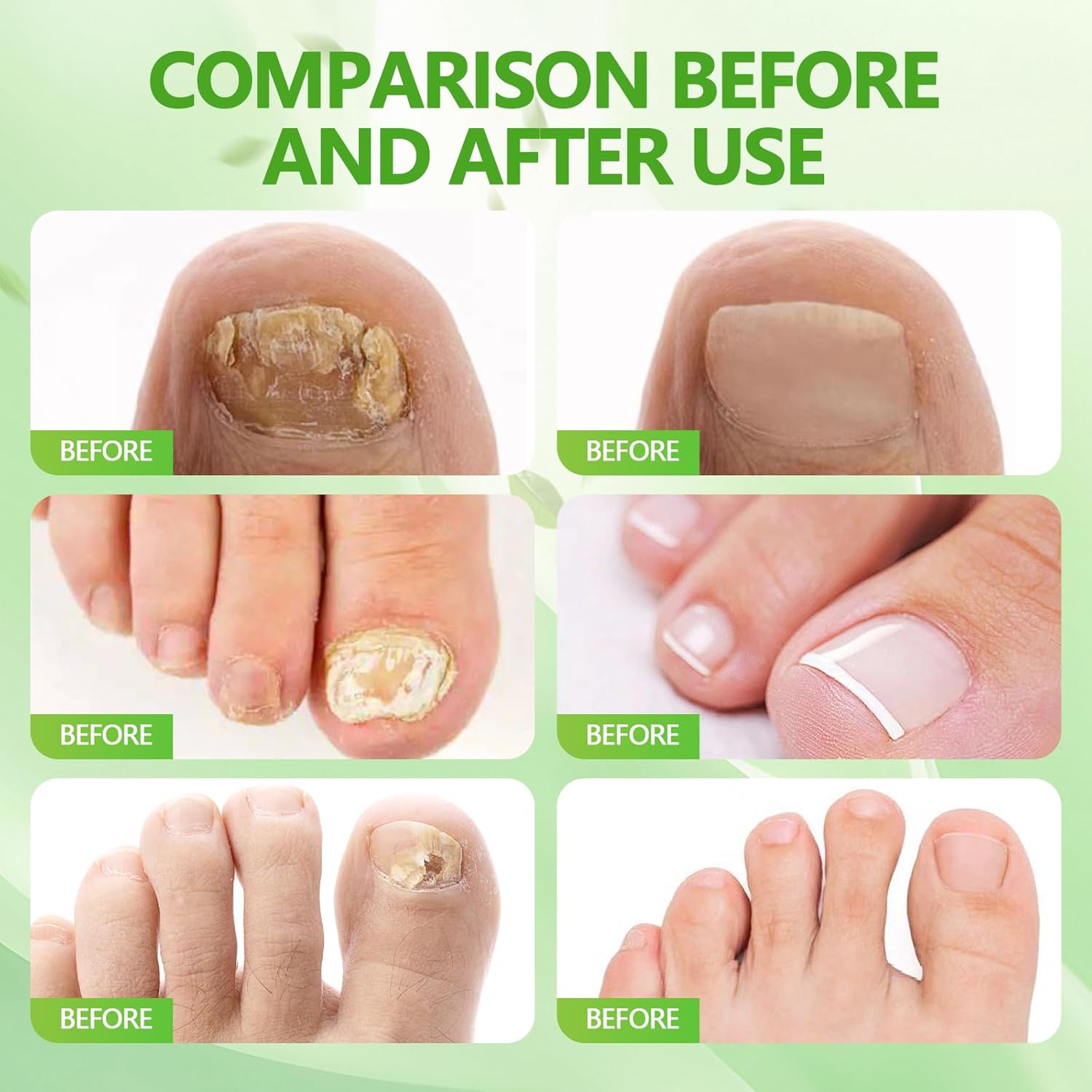 Detalle 2 de Stylos de soins 3 pièces pour ongles 🖊