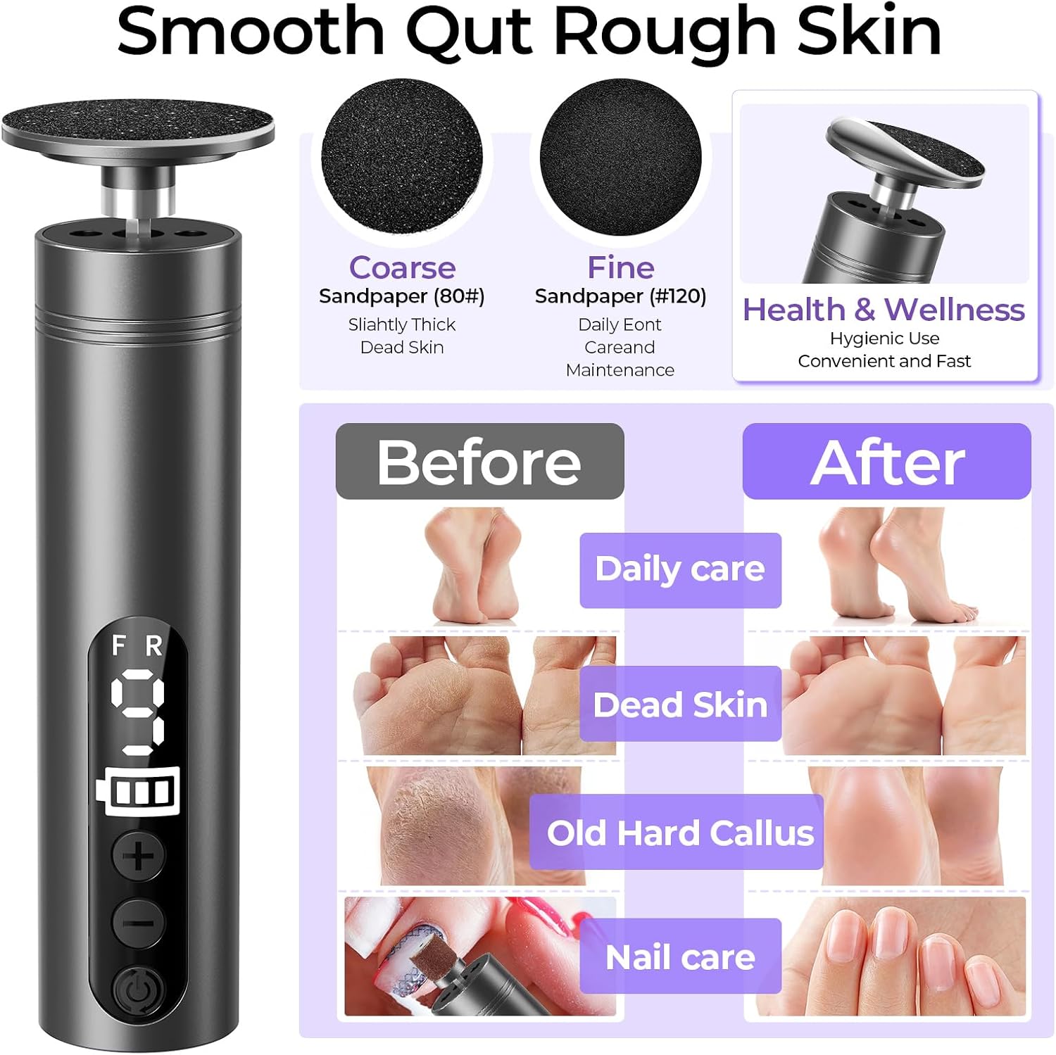 Detalle 2 de Electric Foot File 9‑Speed Rechargeable
