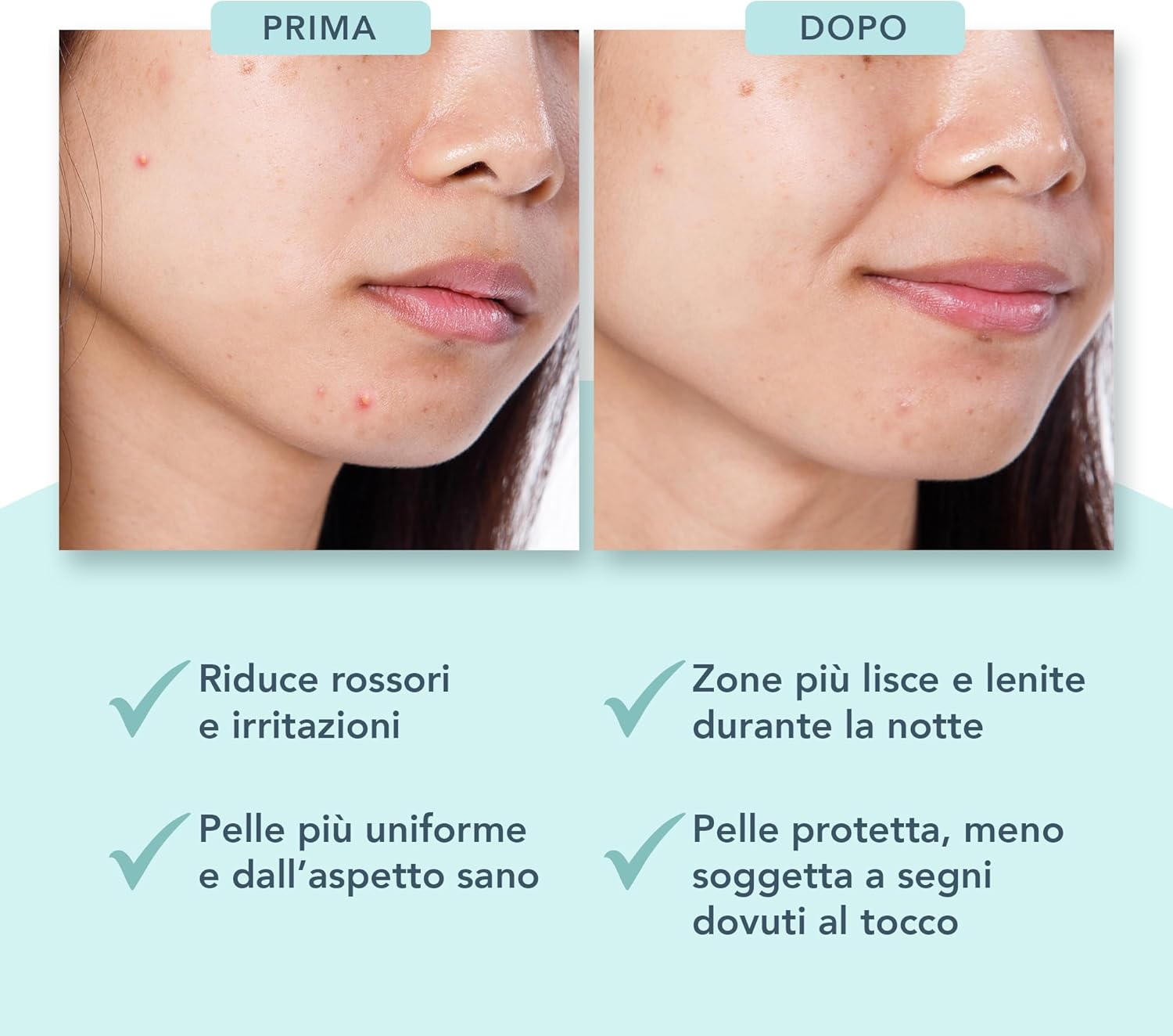 Thumbnail 4 de FOREO FEELING FLAWLESS cerotti invisibili idrocolloidi ai salicilico per brufoli, 48 cerotti