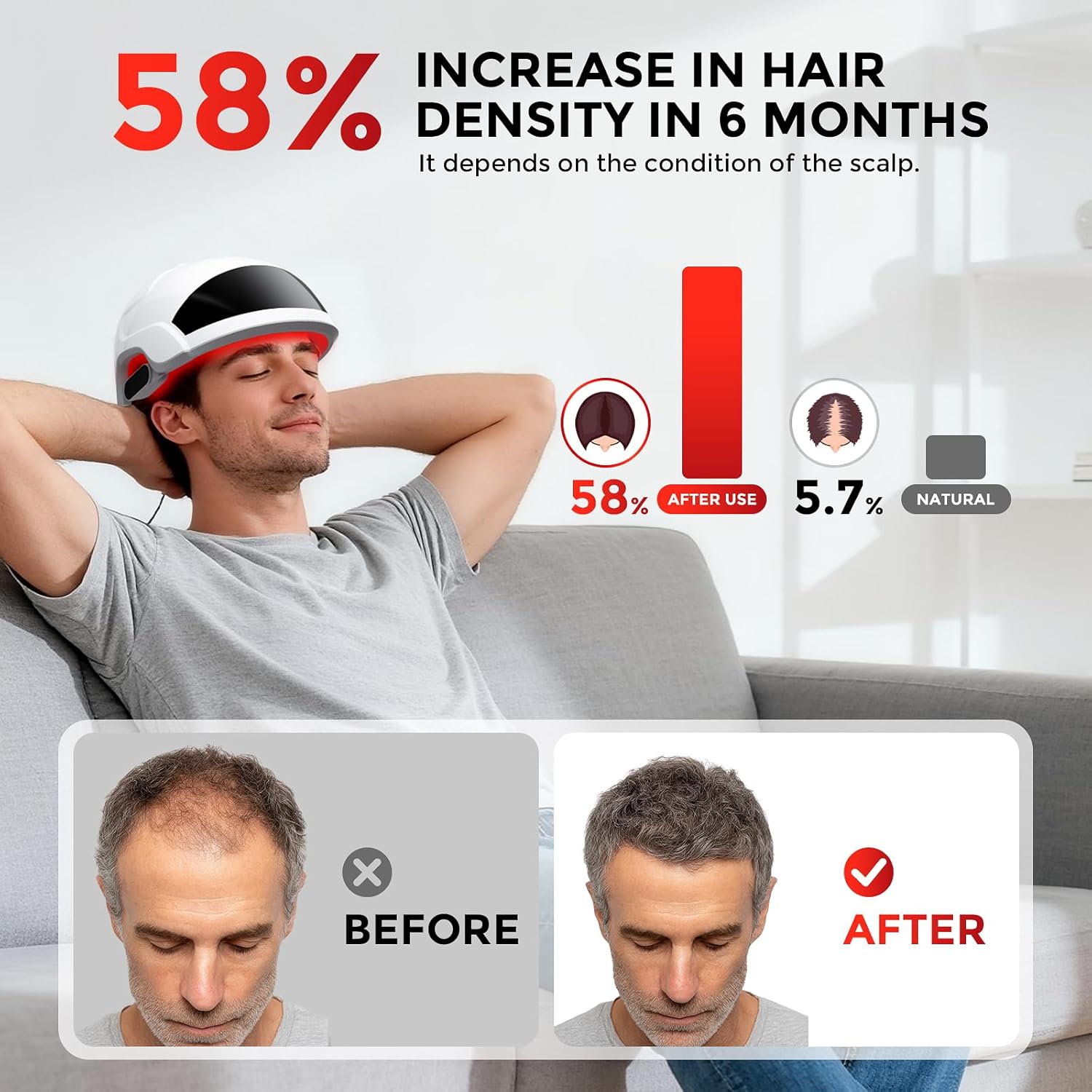 Thumbnail 3 de OVEKPA Red Light Therapy Laser Cap for Hair Growth (FDA-cleared) — at-home LLLT for men & women
